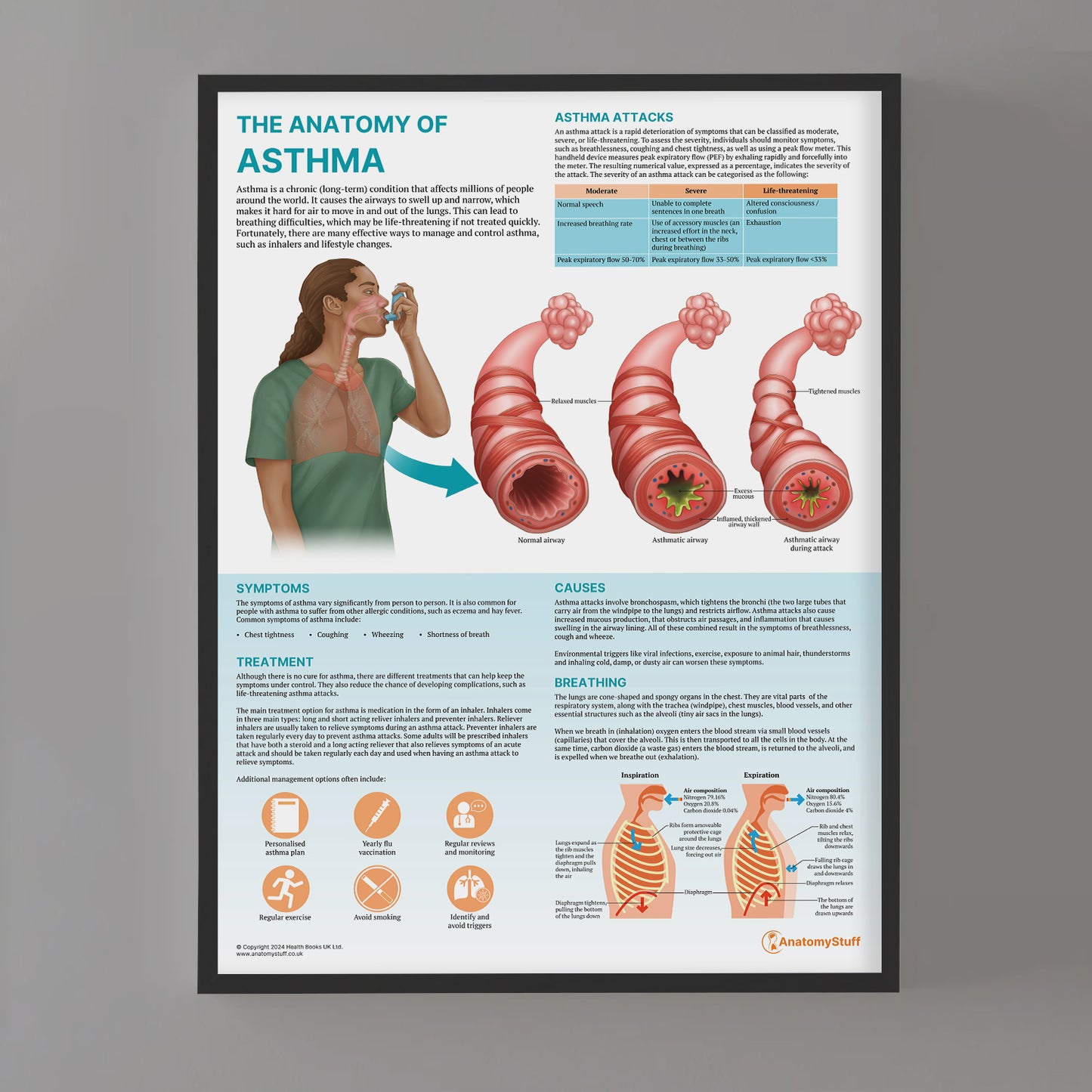 The Anatomy of Asthma Chart / Poster