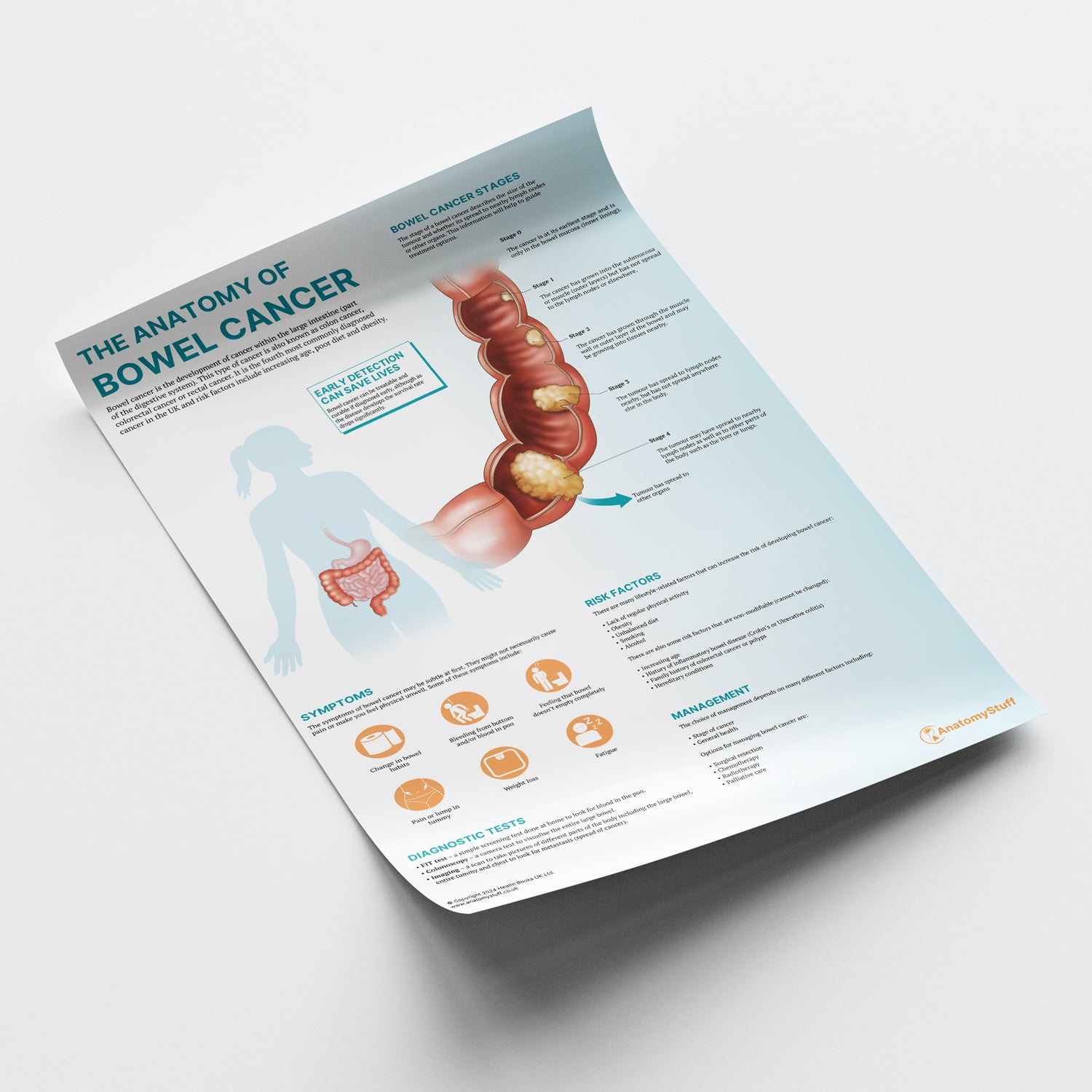 The Anatomy of Bowel Cancer Chart / Poster