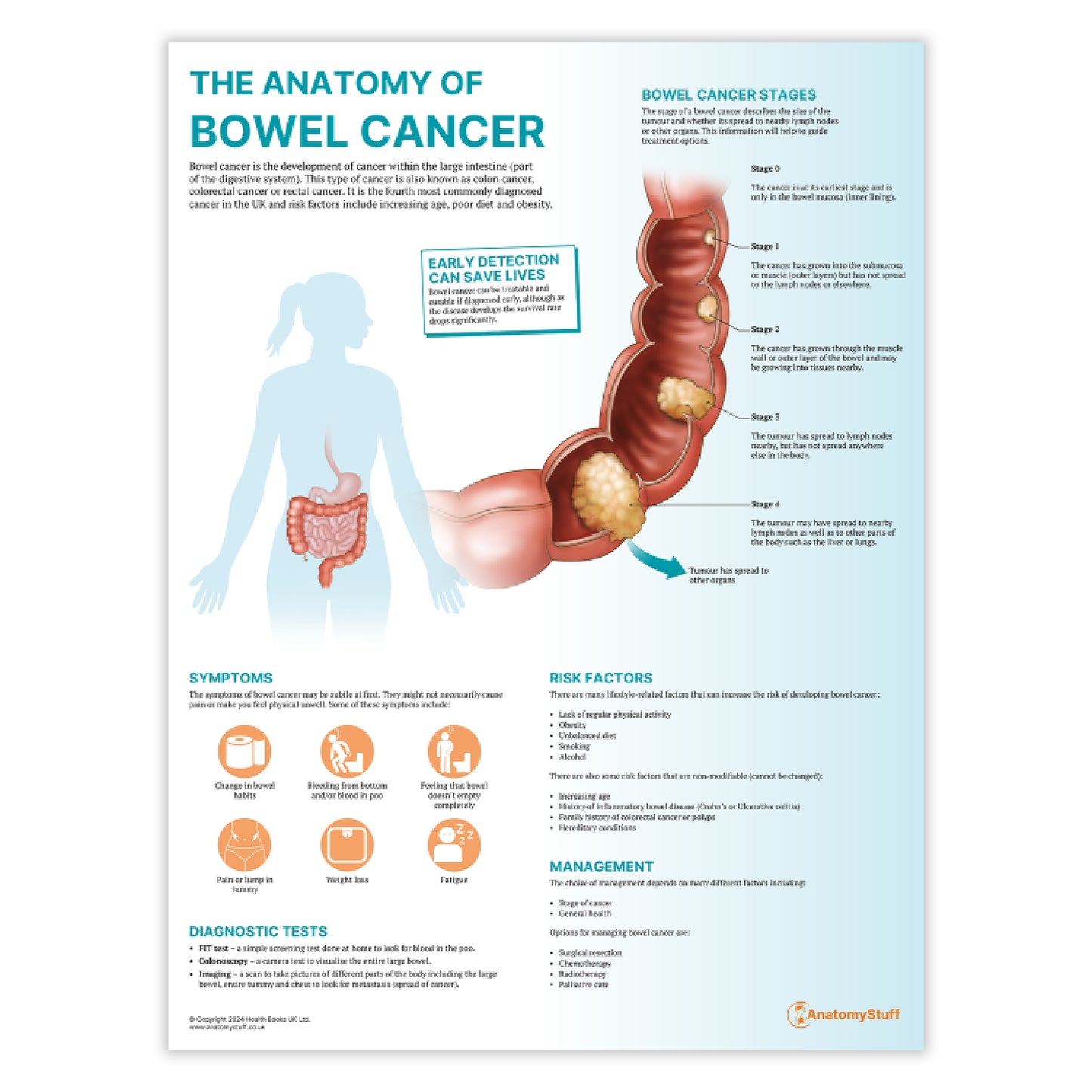 The Anatomy of Bowel Cancer Chart / Poster