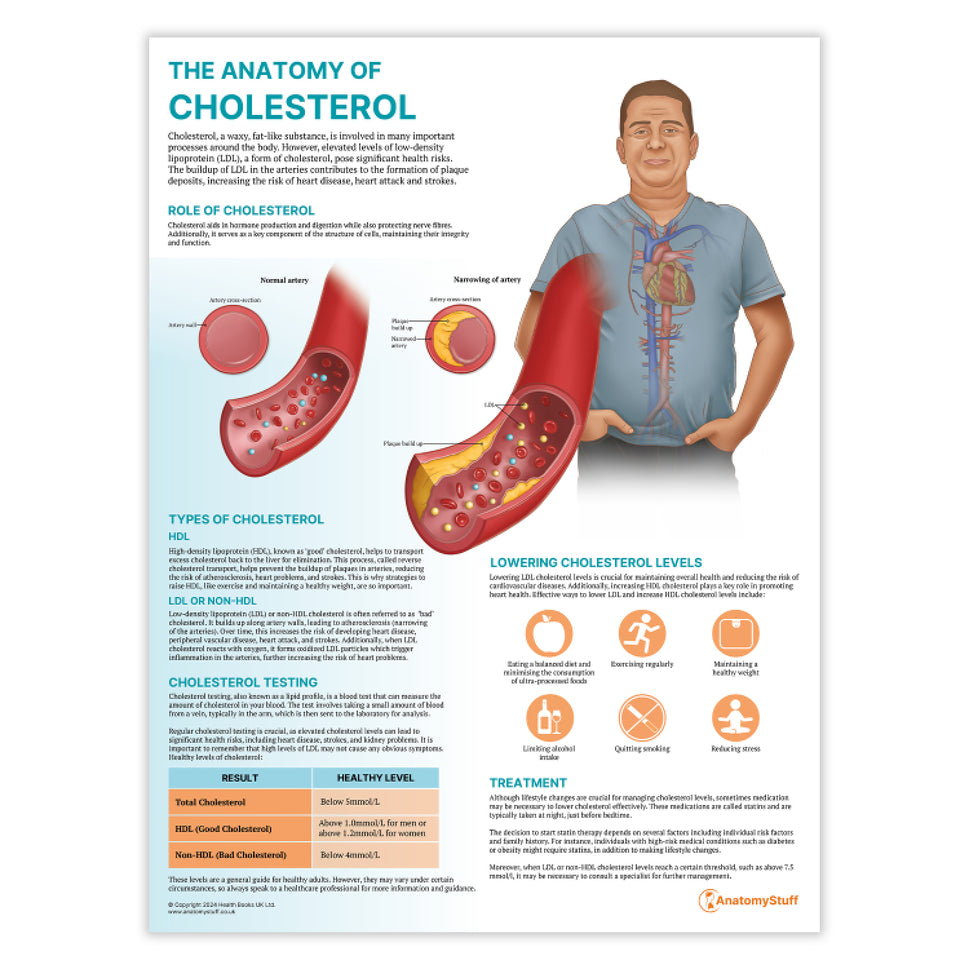 The Anatomy of Cholesterol Chart / Poster
