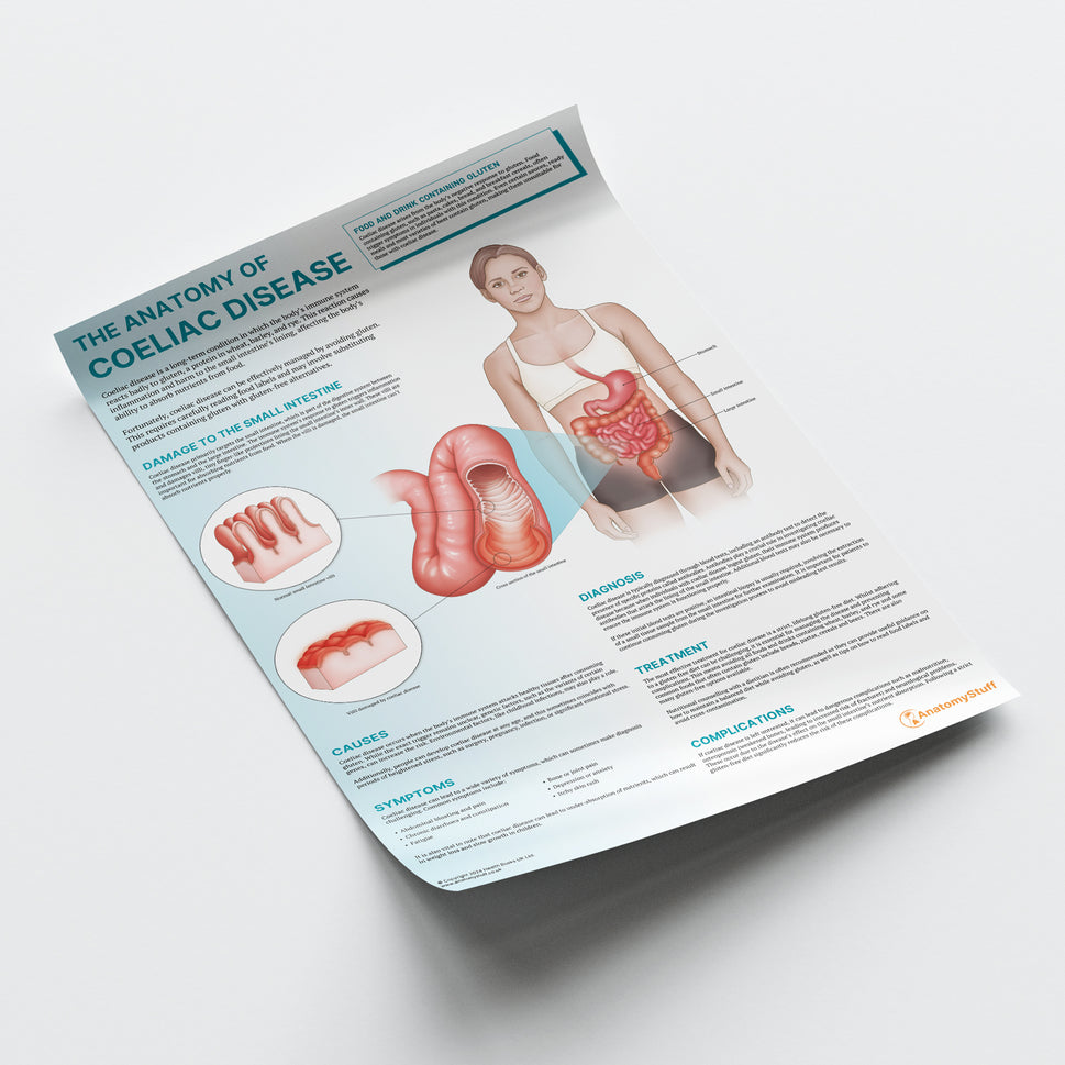The Anatomy of Coeliac Disease Chart / Poster