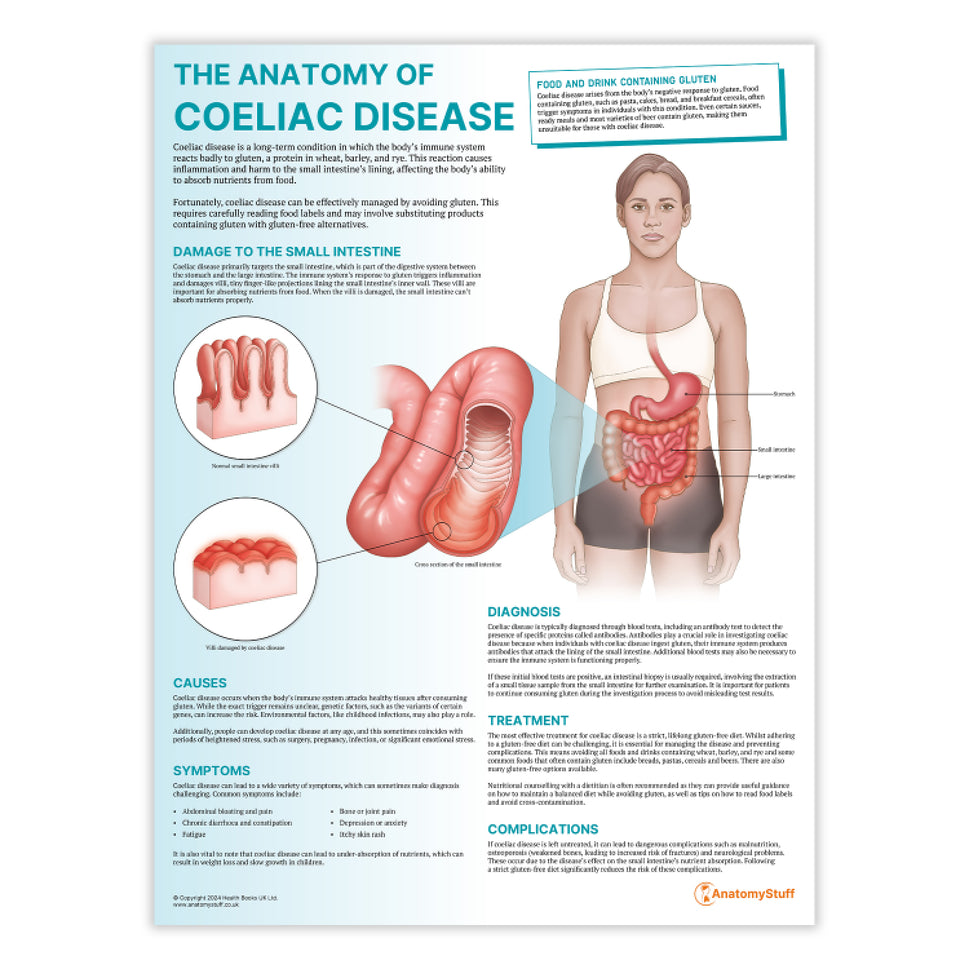 The Anatomy of Coeliac Disease Chart / Poster