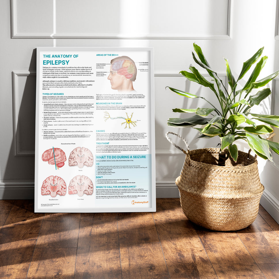 The Anatomy of Epilepsy Chart / Poster