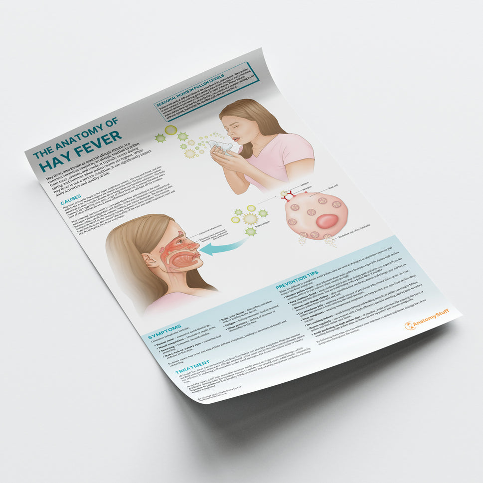 The Anatomy of Hay Fever Chart / Poster