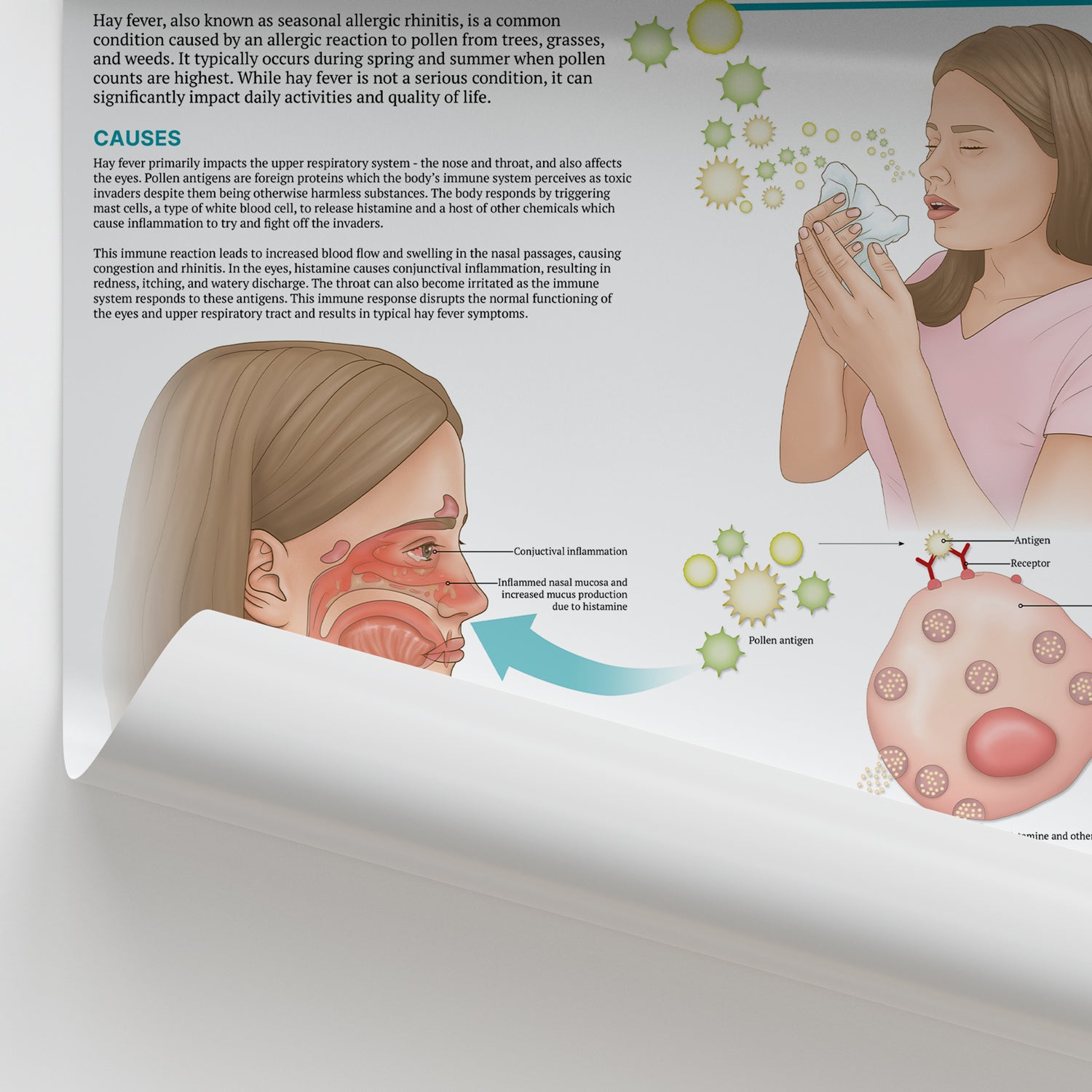 The Anatomy of Hay Fever Chart / Poster