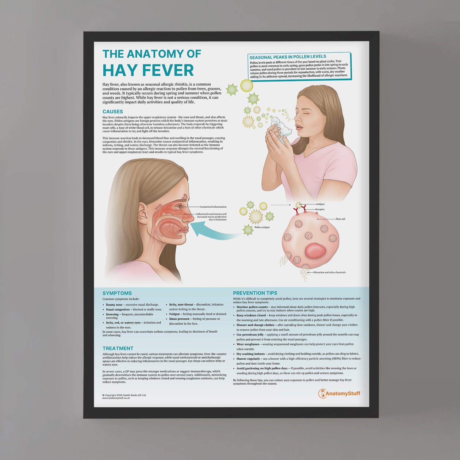 The Anatomy of Hay Fever Chart / Poster