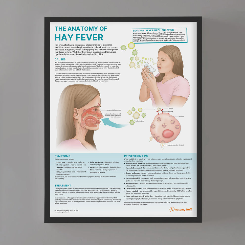 The Anatomy of Hay Fever Chart / Poster