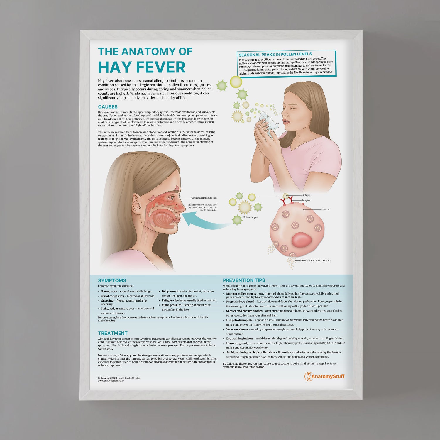 The Anatomy of Hay Fever Chart / Poster