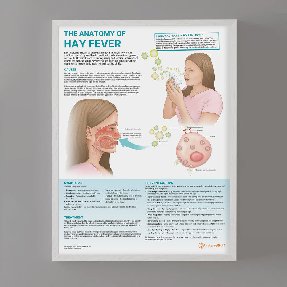 The Anatomy of Hay Fever Chart / Poster