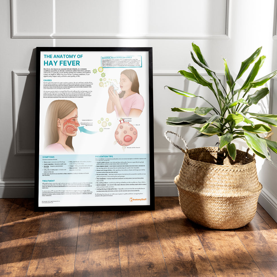 The Anatomy of Hay Fever Chart / Poster