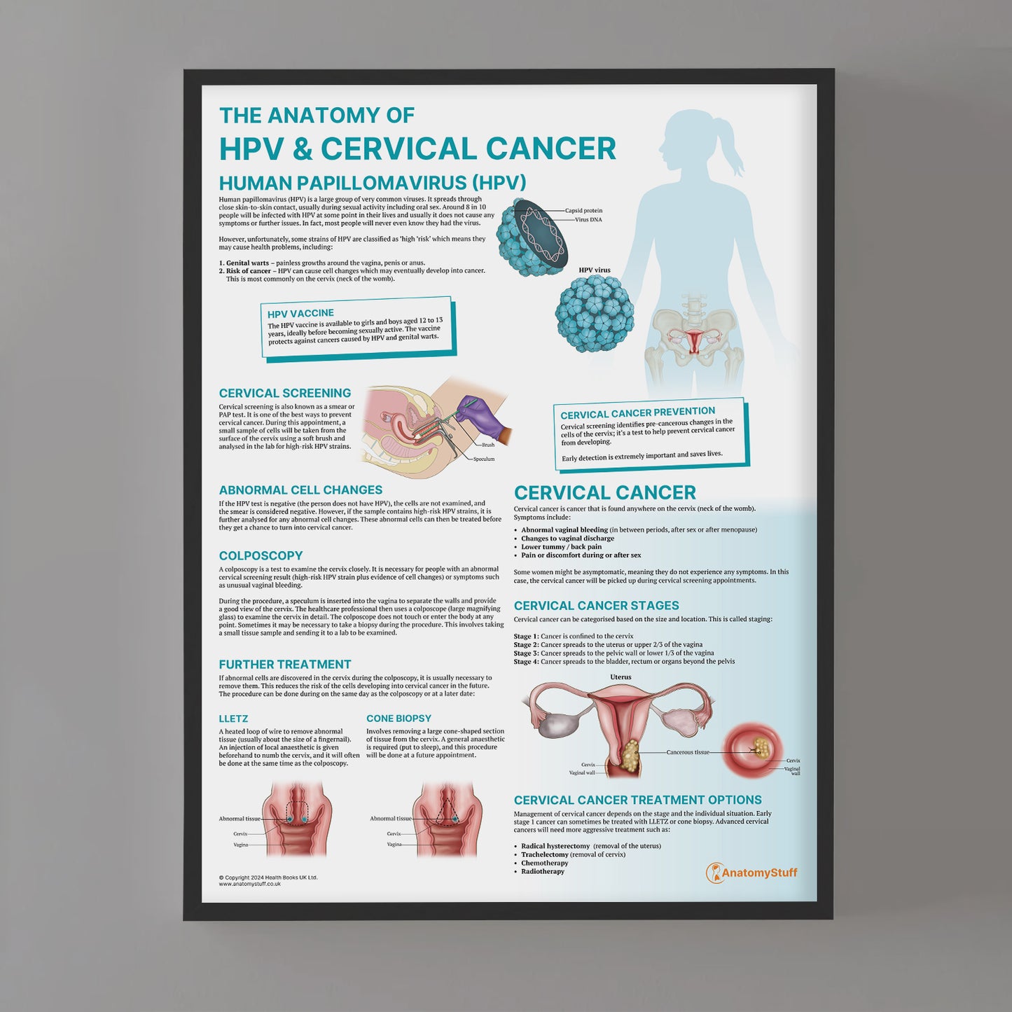 The Anatomy of HPV & Cervical Cancer Chart / Poster