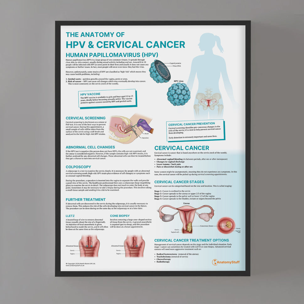 The Anatomy of HPV & Cervical Cancer Chart / Poster