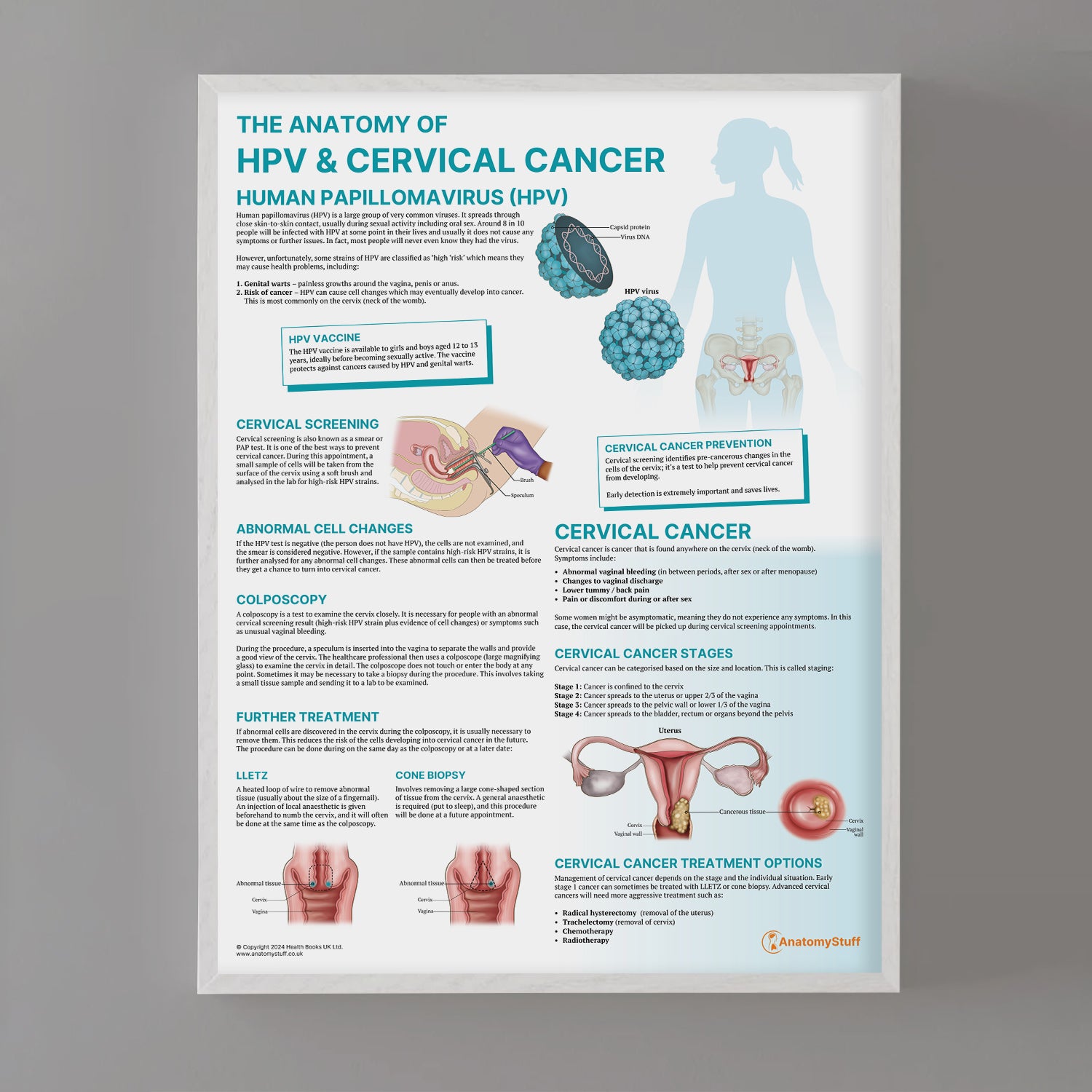 The Anatomy of HPV & Cervical Cancer Chart / Poster