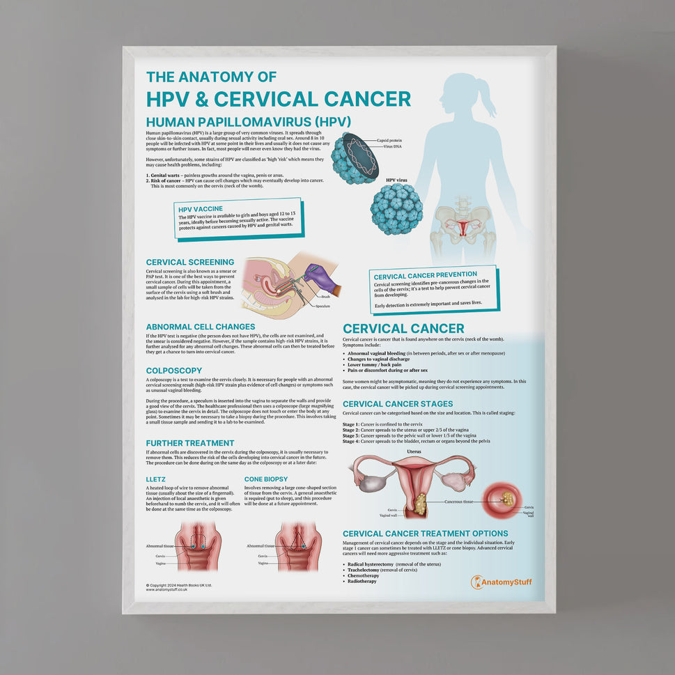 The Anatomy of HPV & Cervical Cancer Chart / Poster