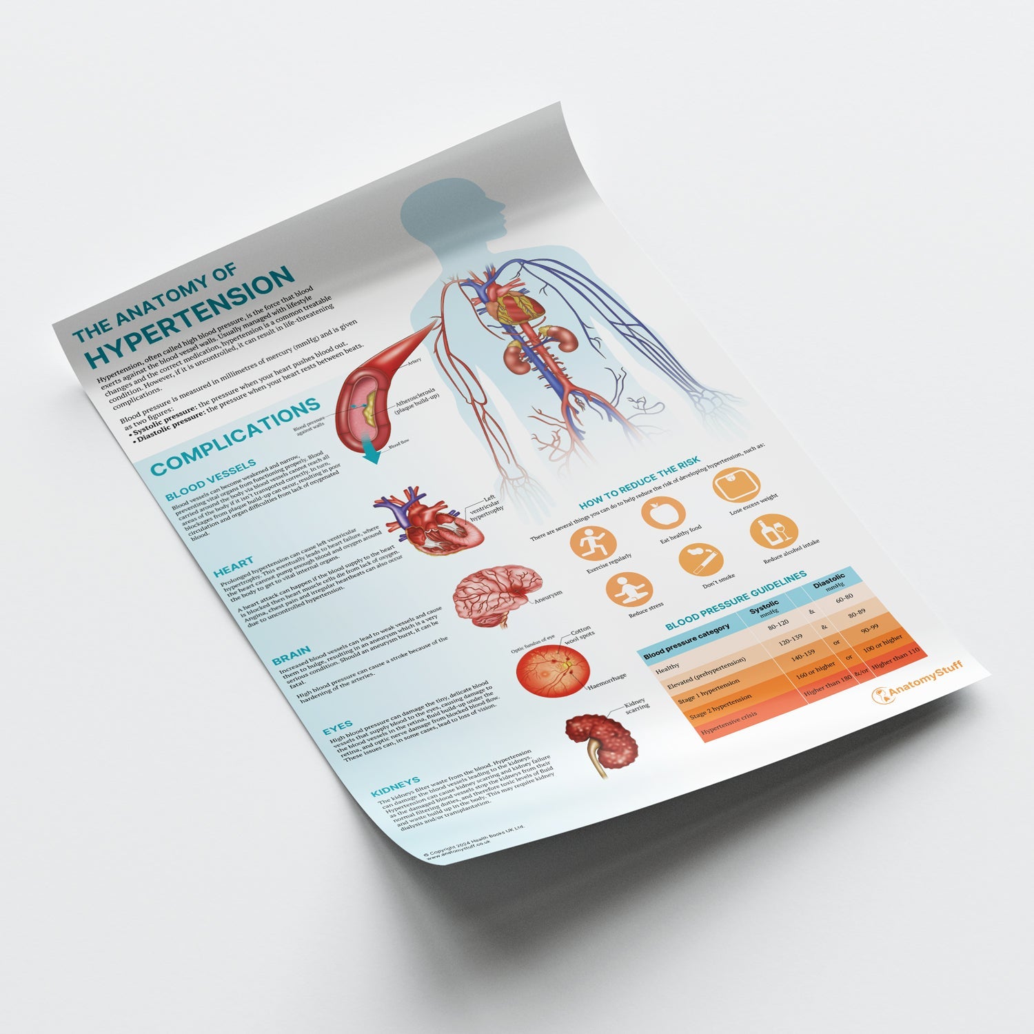 The Anatomy of Hypertension Chart / Poster - Part of Collection