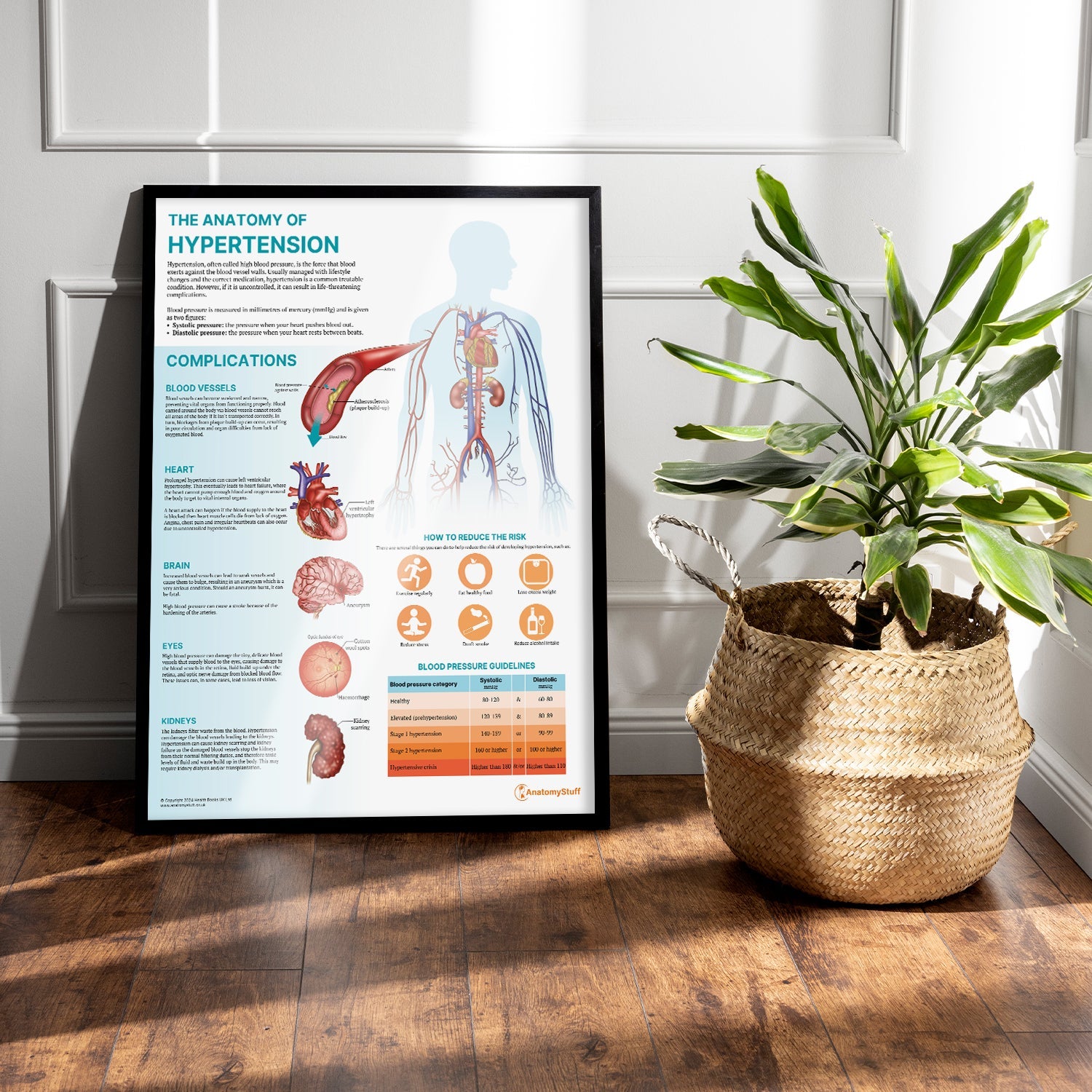 The Anatomy of Hypertension Chart / Poster - Part of Collection