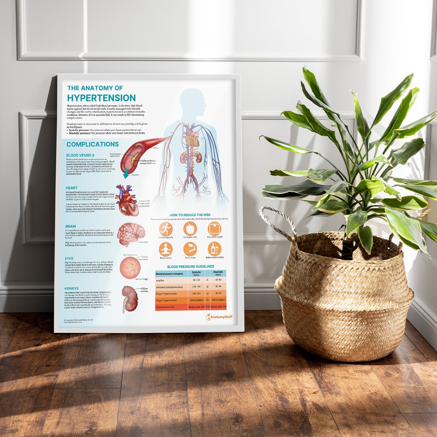 The Anatomy of Hypertension Chart / Poster - Part of Collection