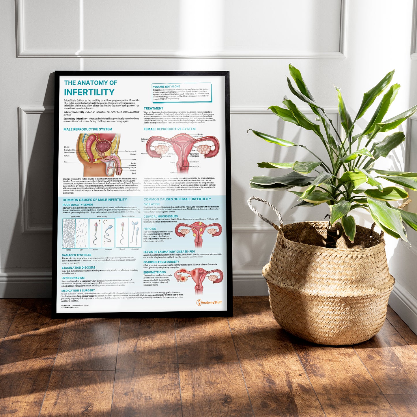 The Anatomy of Infertility Chart / Poster