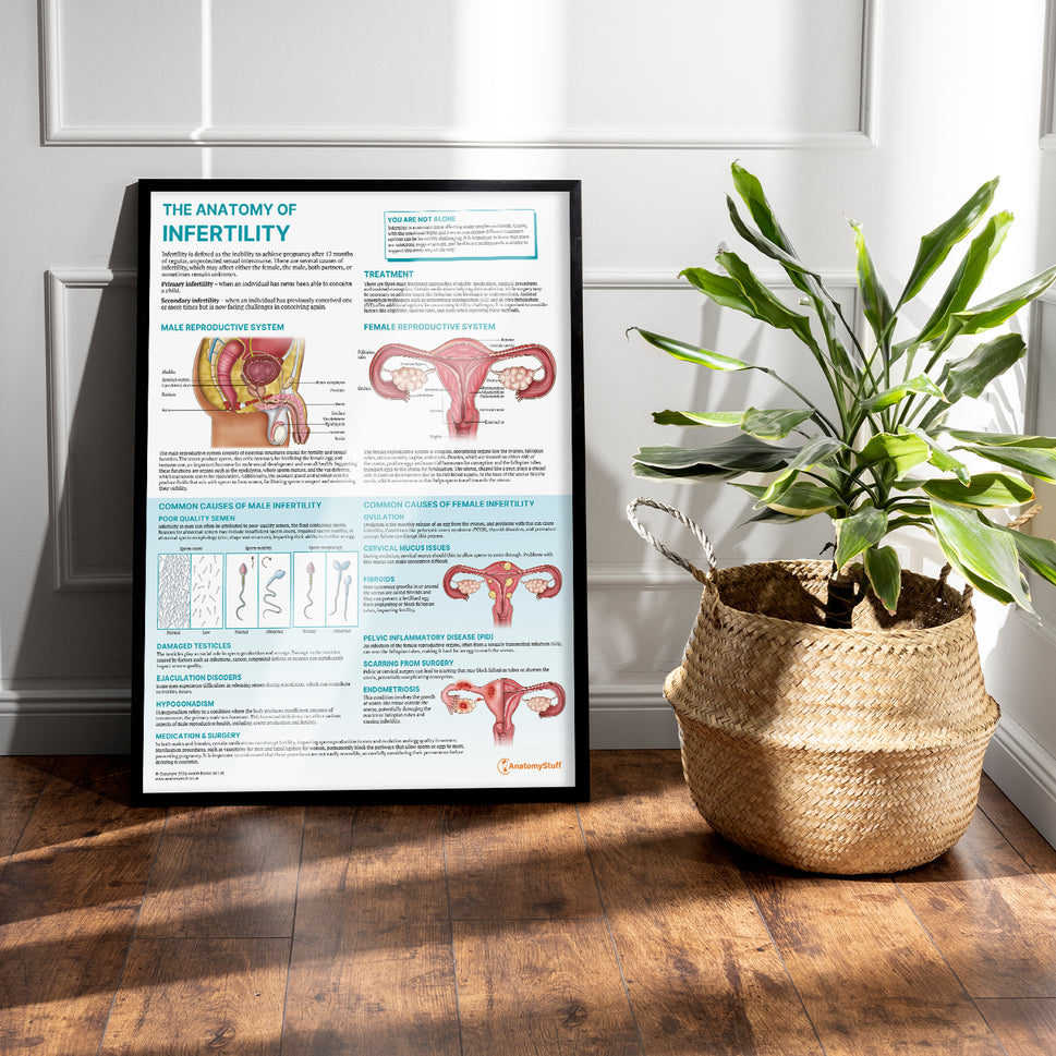 The Anatomy of Infertility Chart / Poster