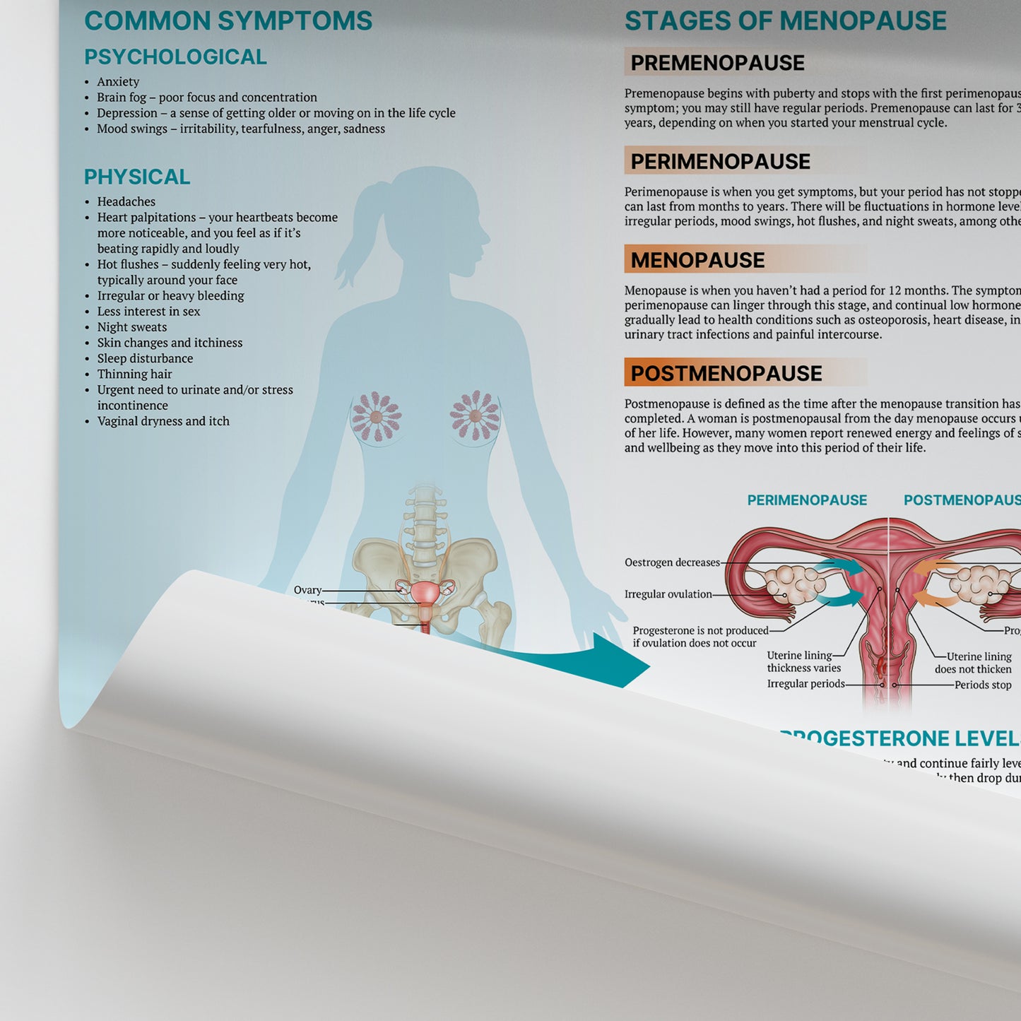 The Anatomy of Menopause Chart / Poster