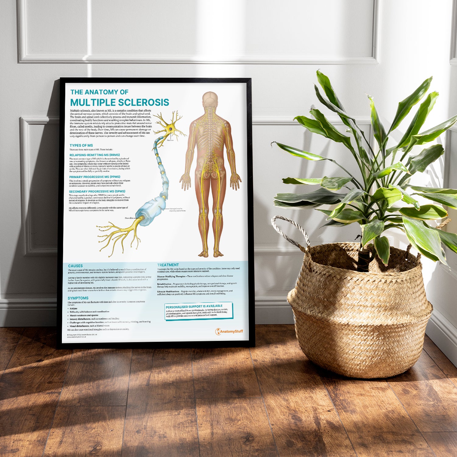 The Anatomy of Multiple Sclerosis Chart / Poster
