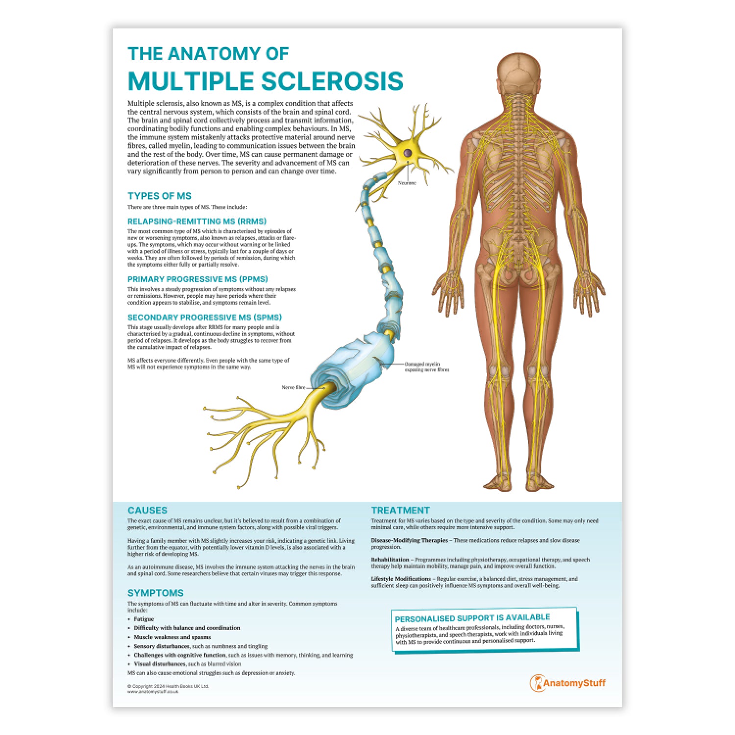 The Anatomy of Multiple Sclerosis Chart / Poster