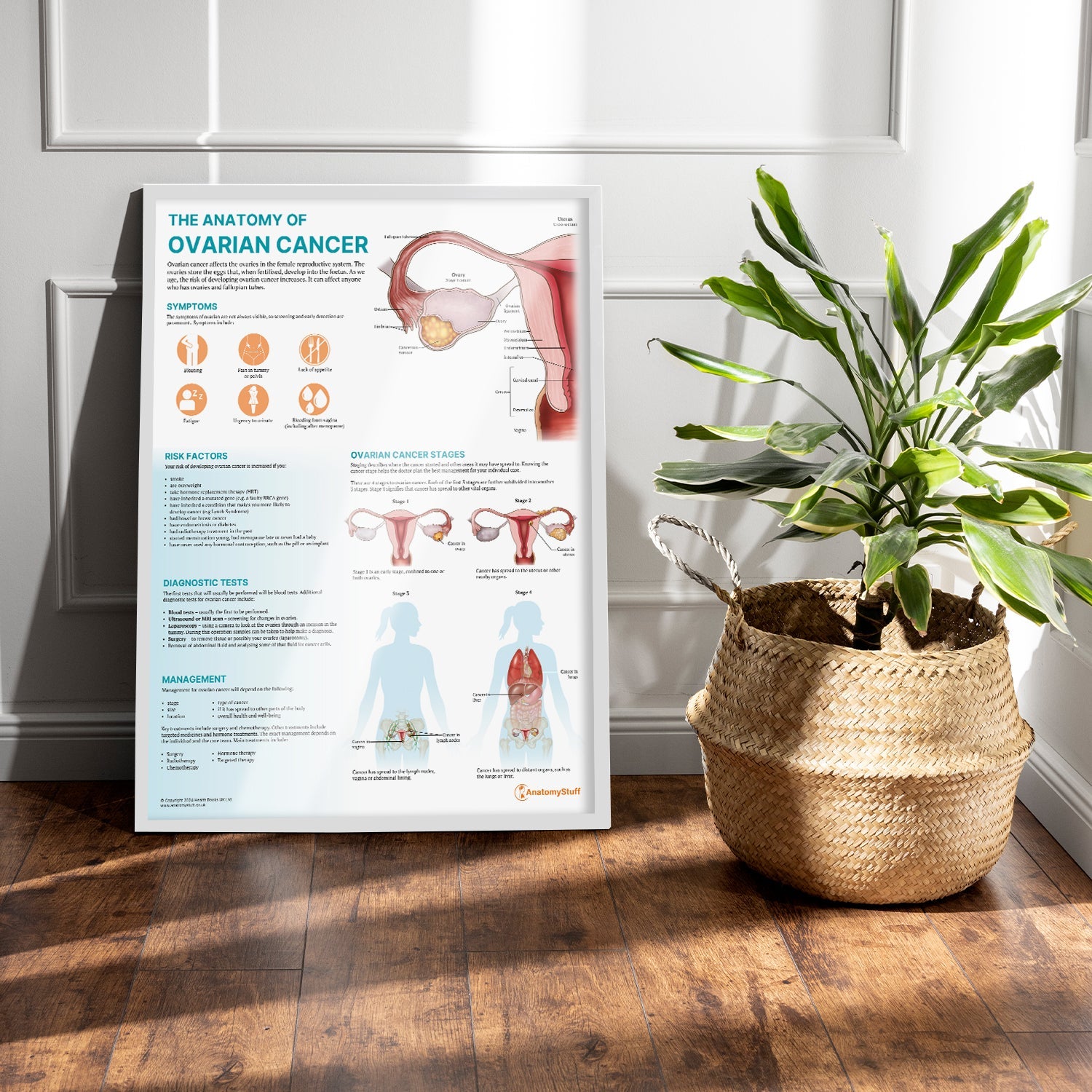 The Anatomy of Ovarian Cancer Chart / Poster - Part of Collection