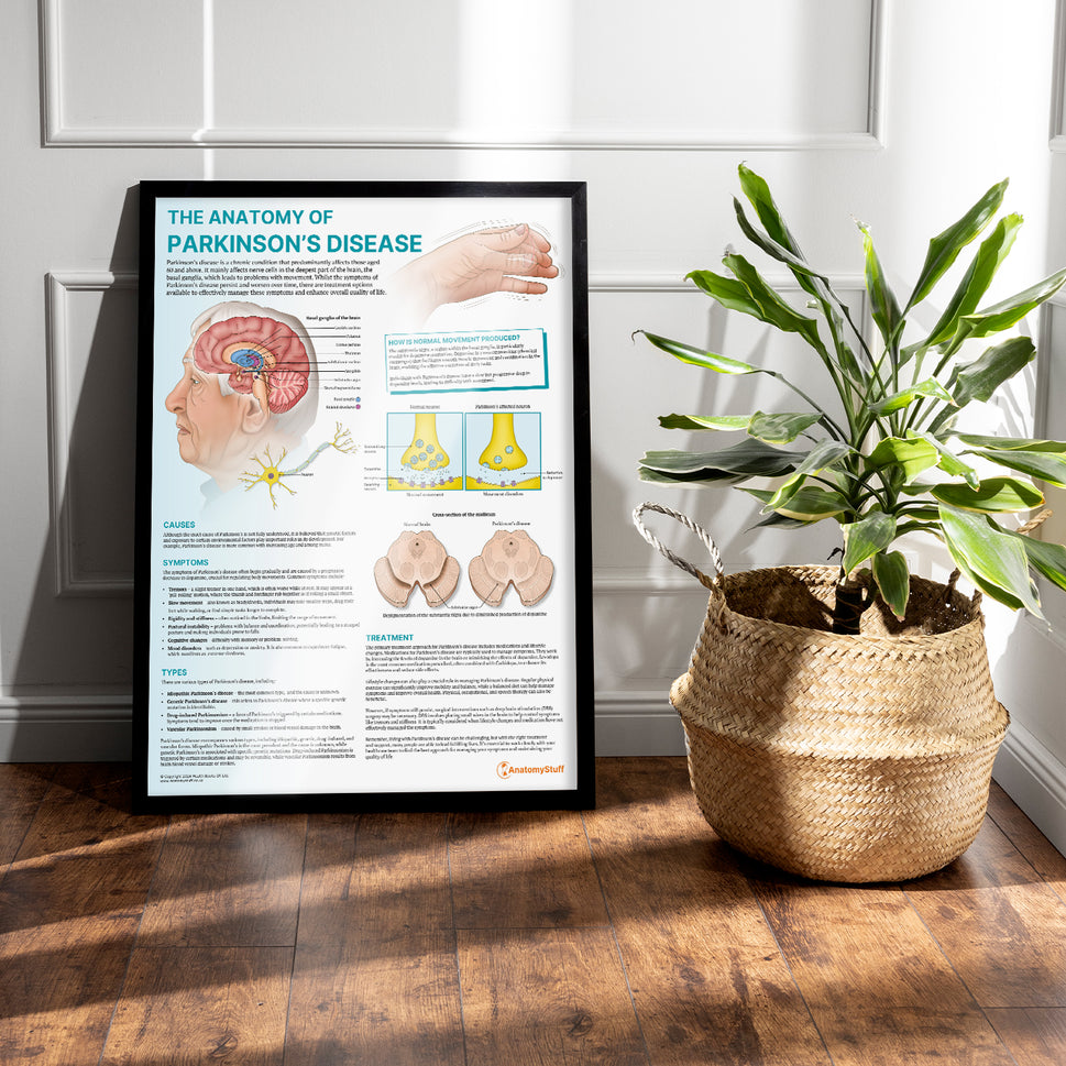 The Anatomy of Parkinson's Disease Chart / Poster