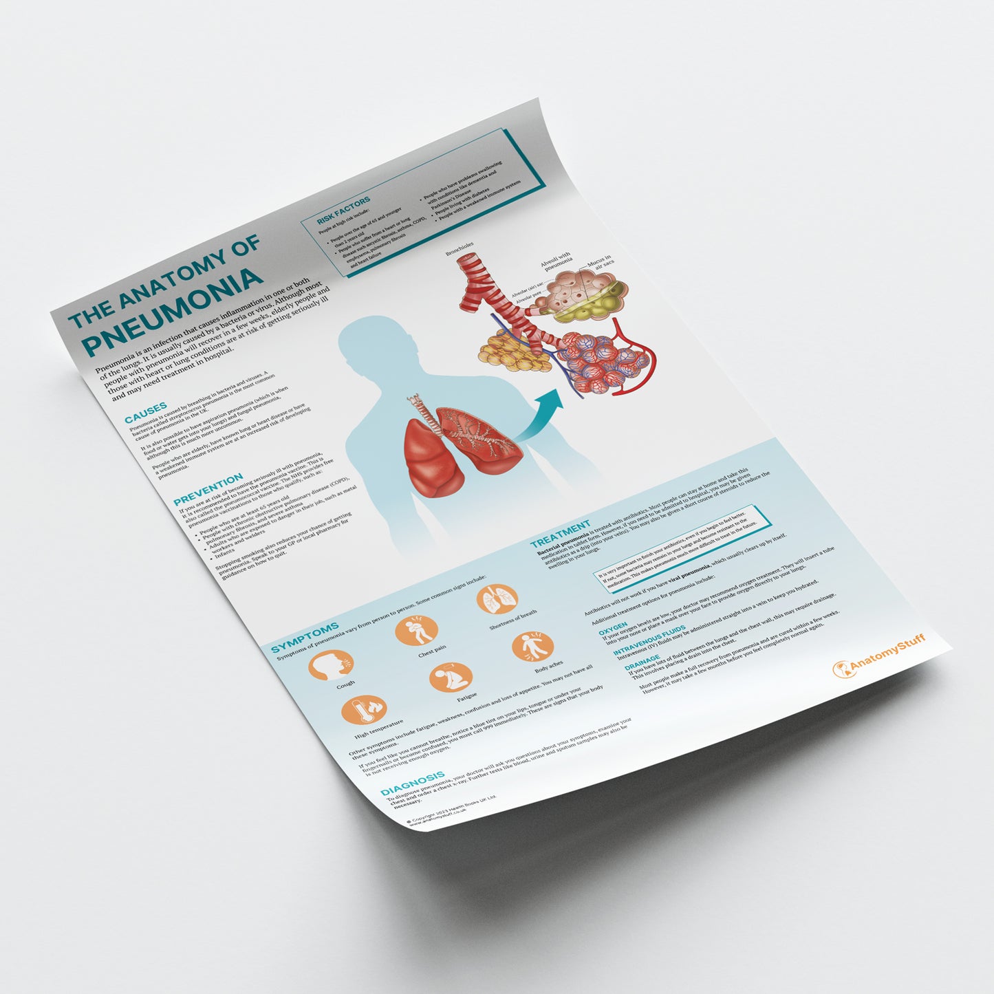 The Anatomy of Pneumonia  Chart / Poster