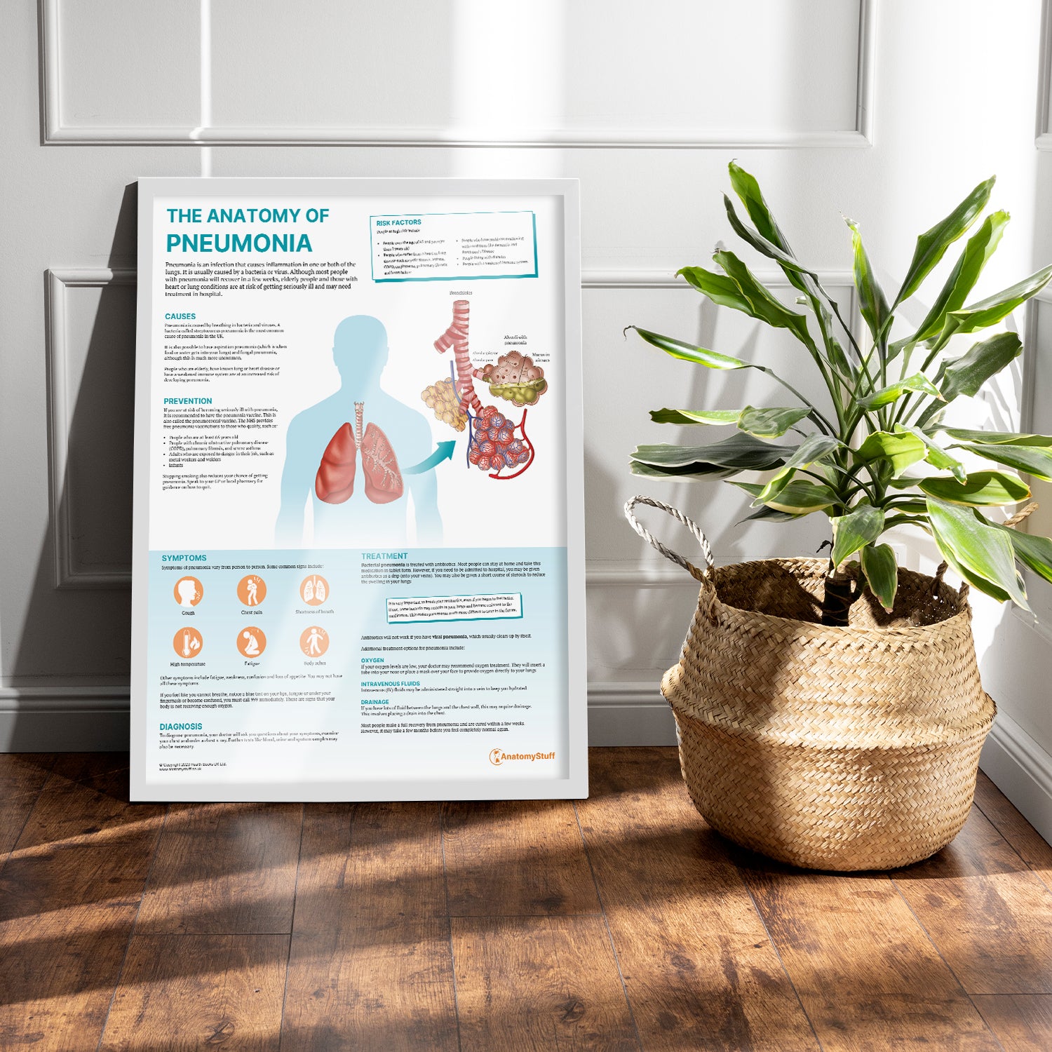 The Anatomy of Pneumonia  Chart / Poster
