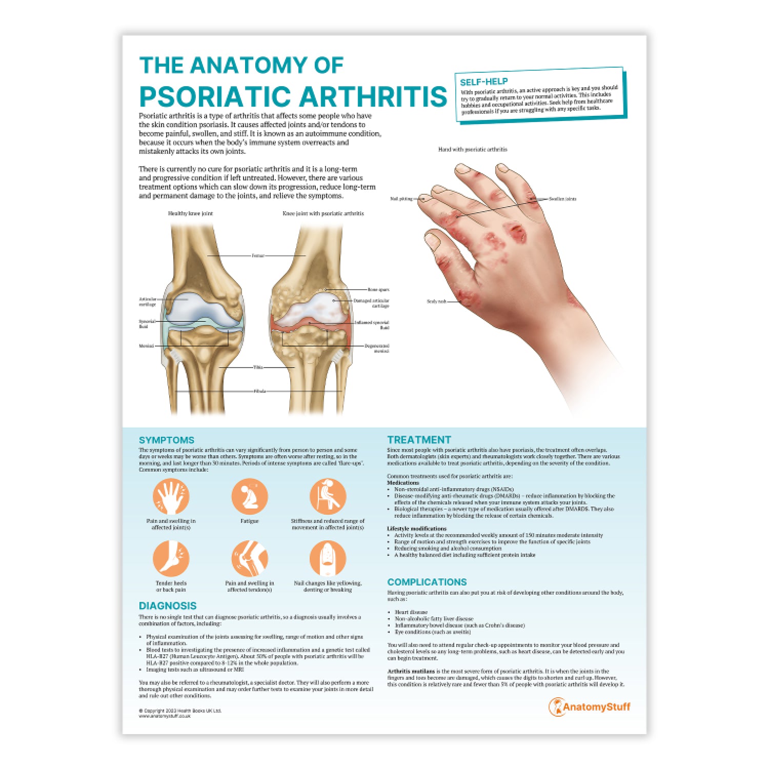 The Anatomy of Psoriatic Arthritis Chart / Poster