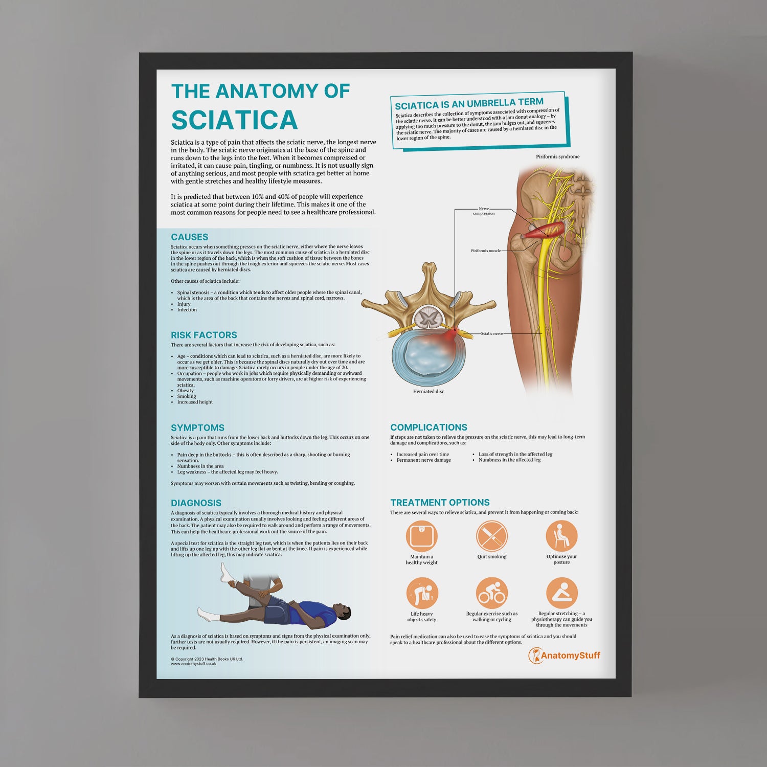 The Anatomy of Sciatica Chart / Poster