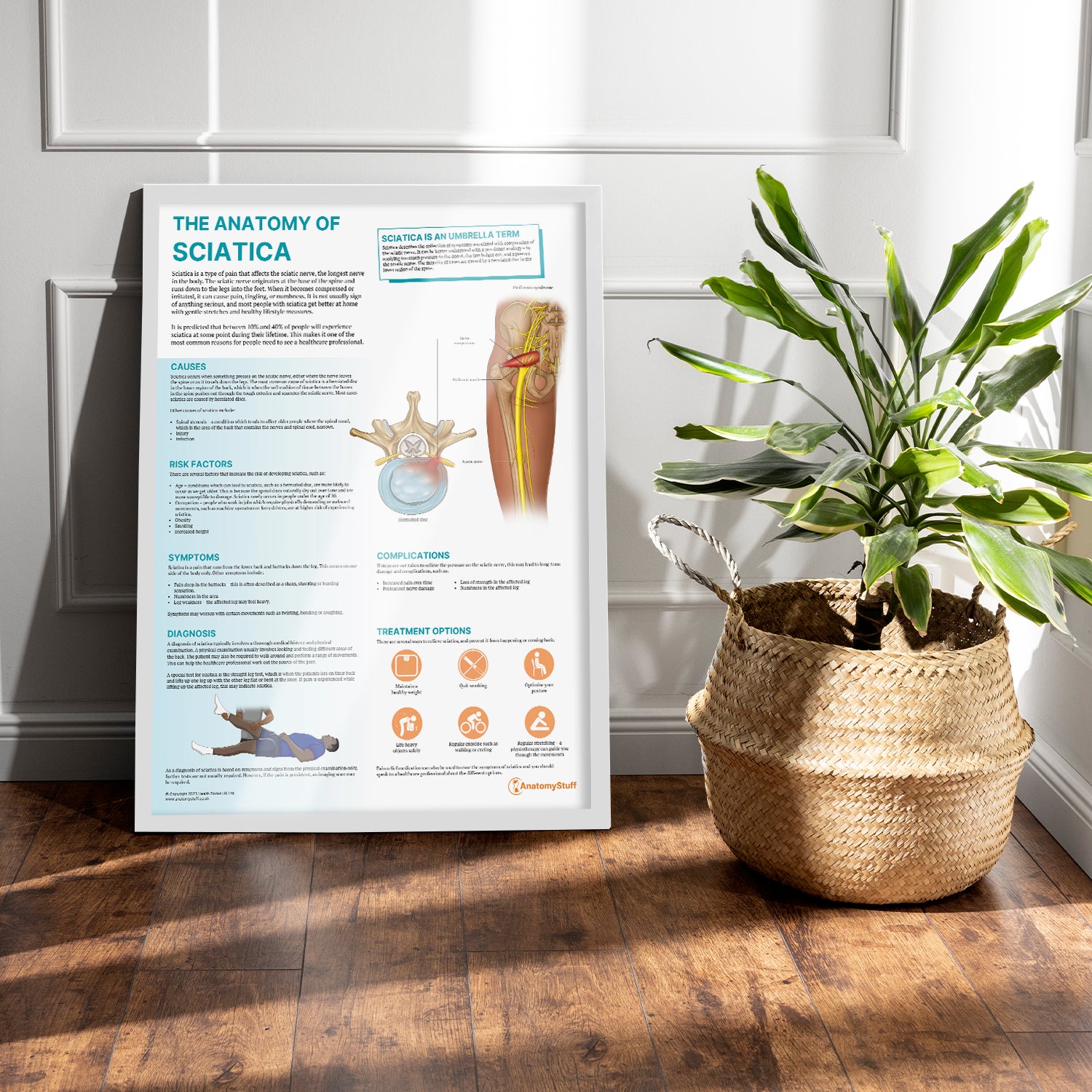 The Anatomy of Sciatica Chart / Poster