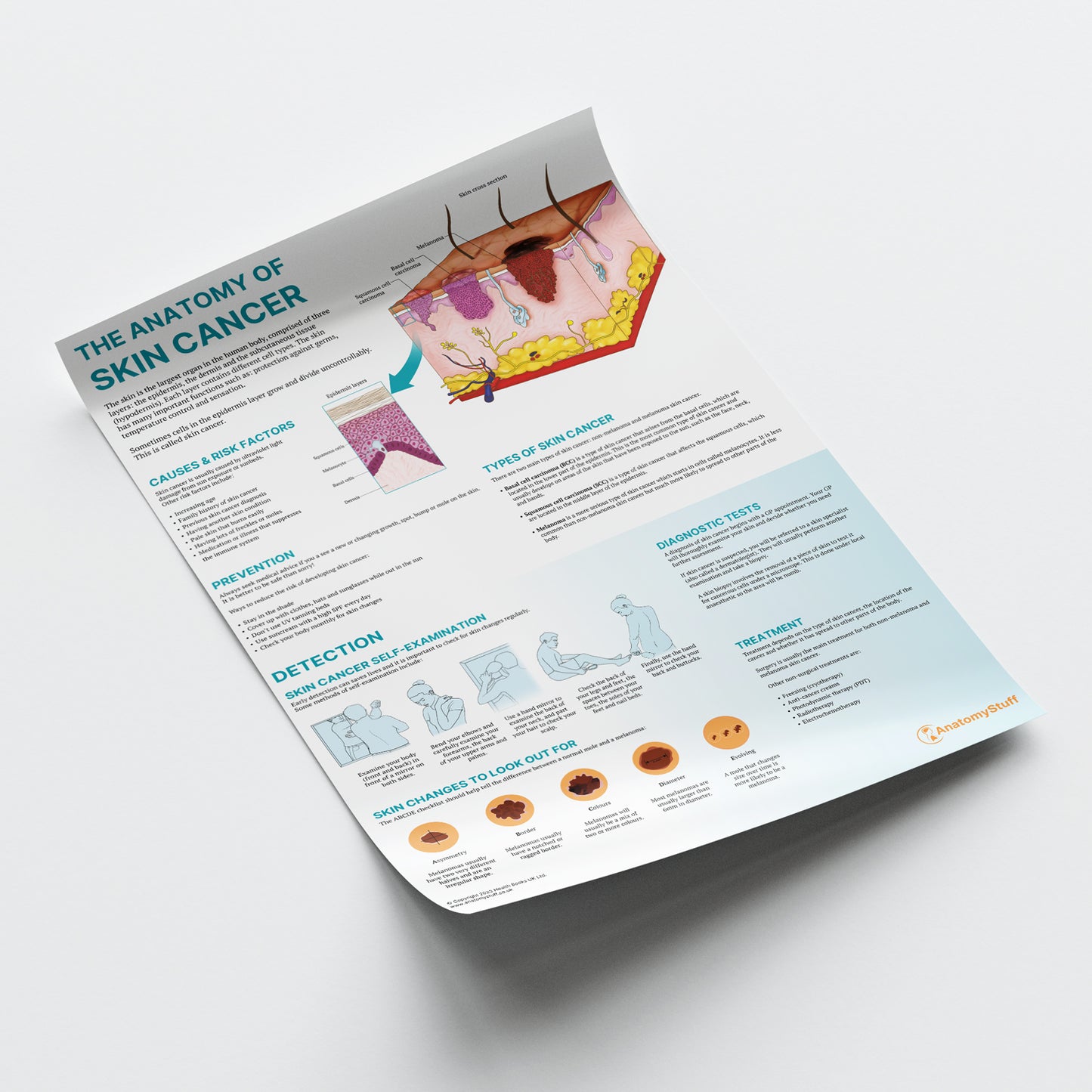 The Anatomy of Skin Cancer Chart / Poster