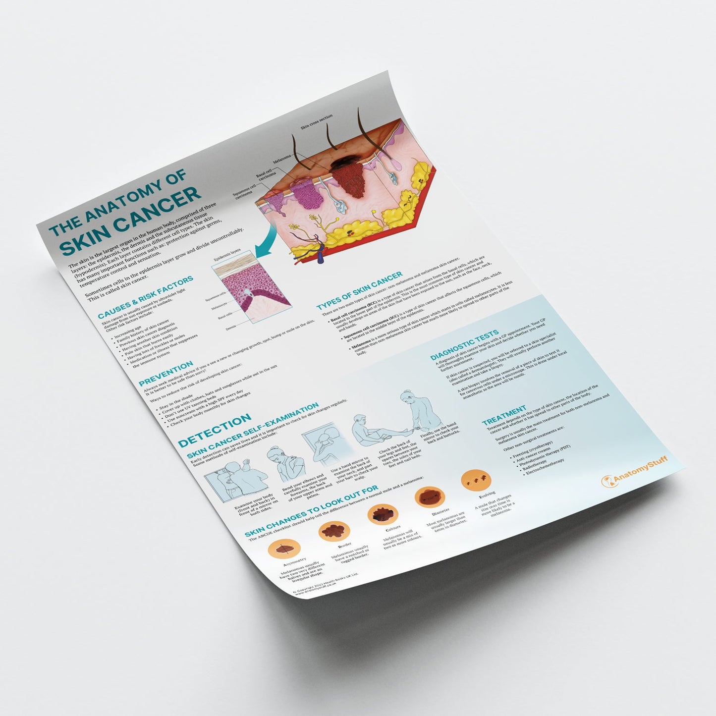 The Anatomy of Skin Cancer  Chart / Poster - Part of Collection