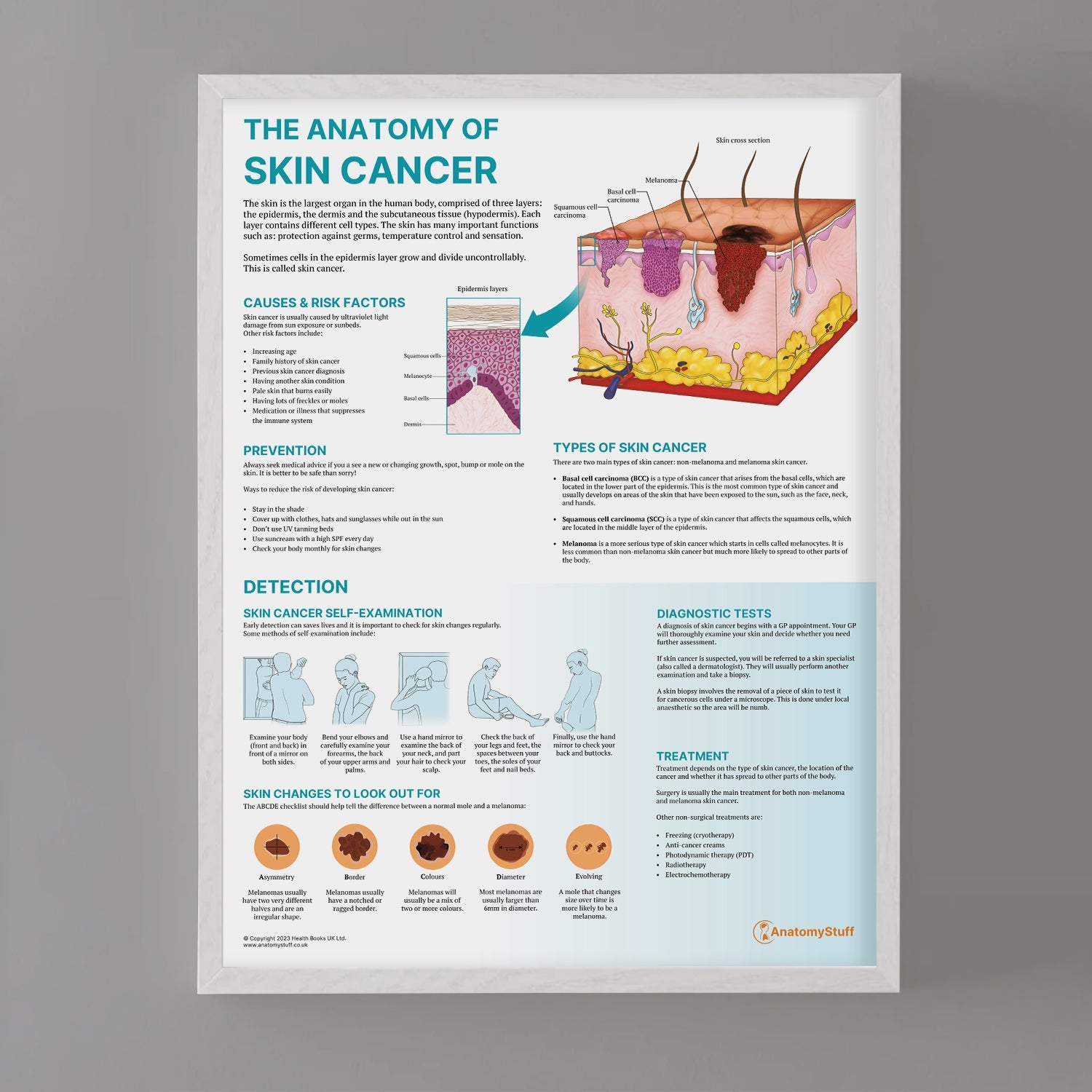 The Anatomy of Skin Cancer  Chart / Poster - Part of Collection