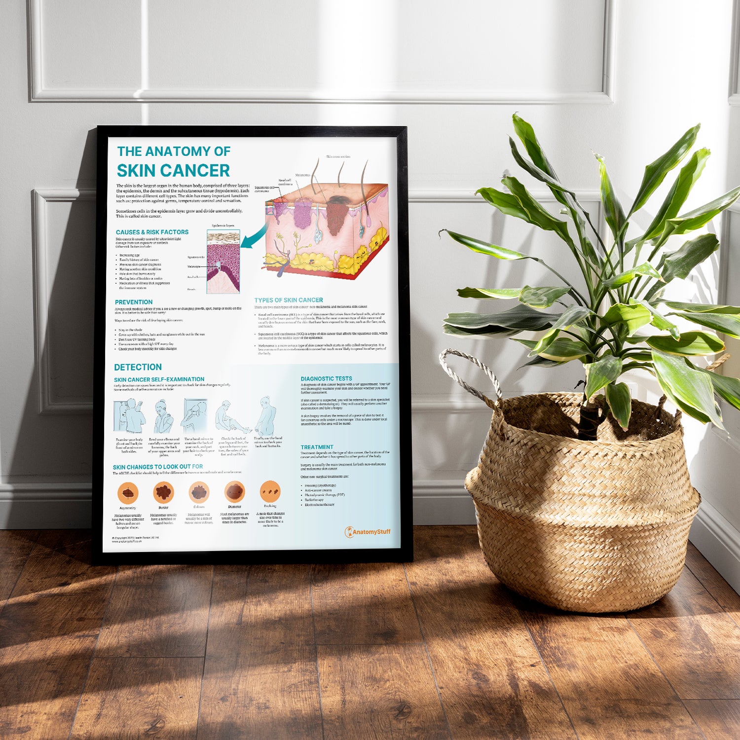 The Anatomy of Skin Cancer Chart / Poster