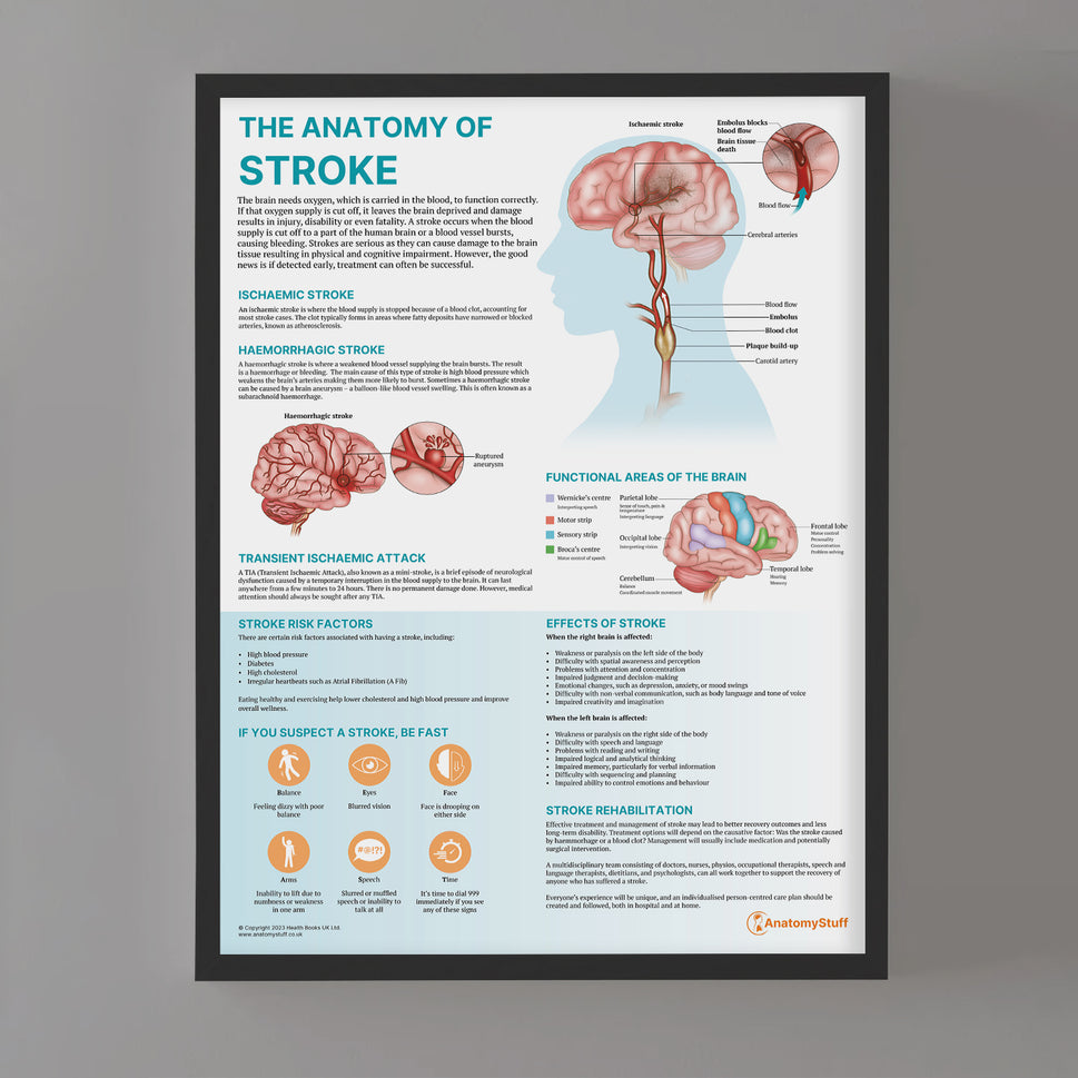 The Anatomy of Stroke Chart / Poster
