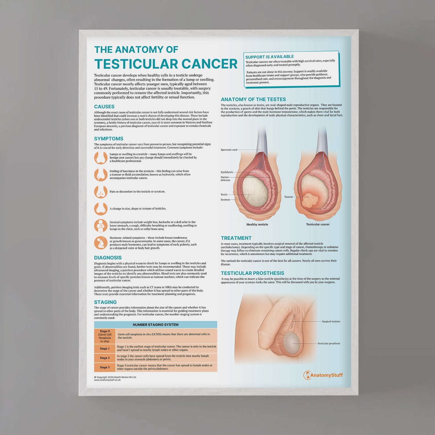 The Anatomy of Testicular Cancer Chart / Poster - Part of Collection