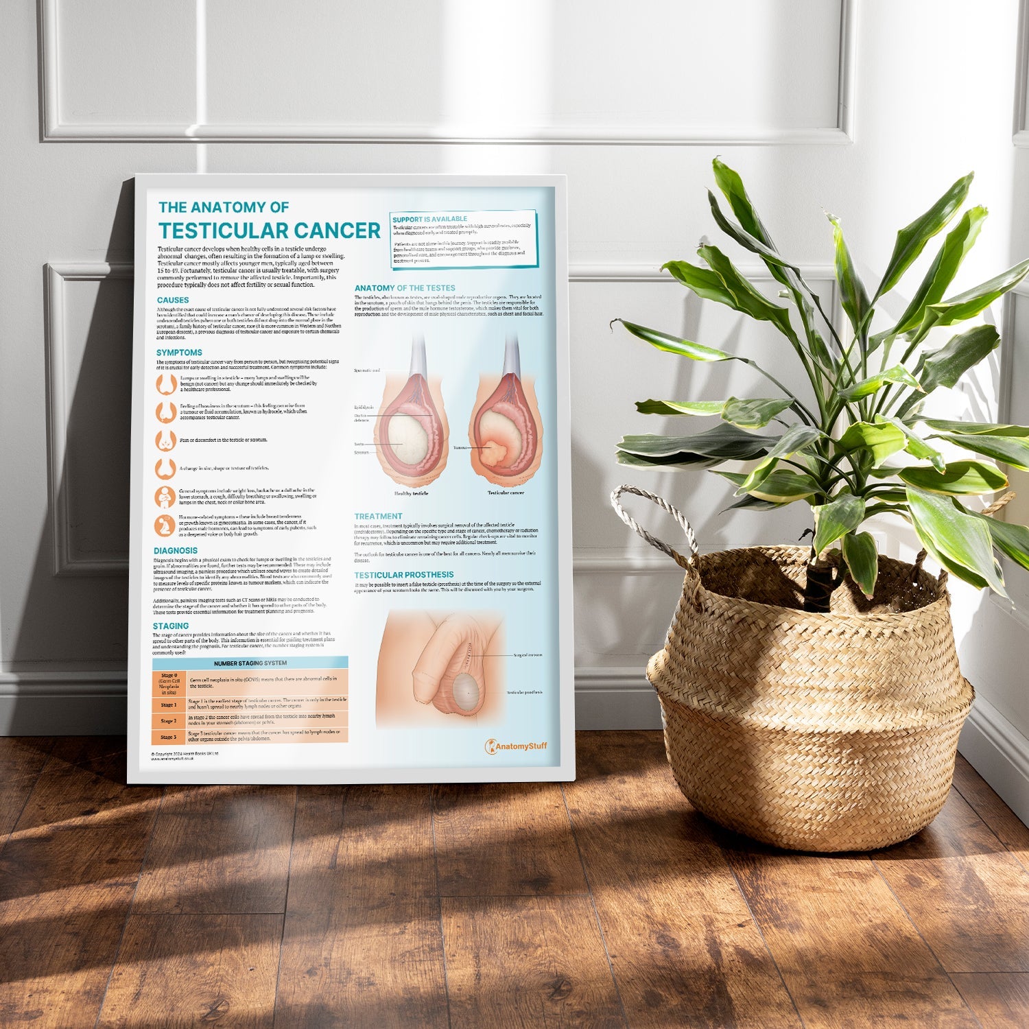 The Anatomy of Testicular Cancer Chart / Poster - Part of Collection