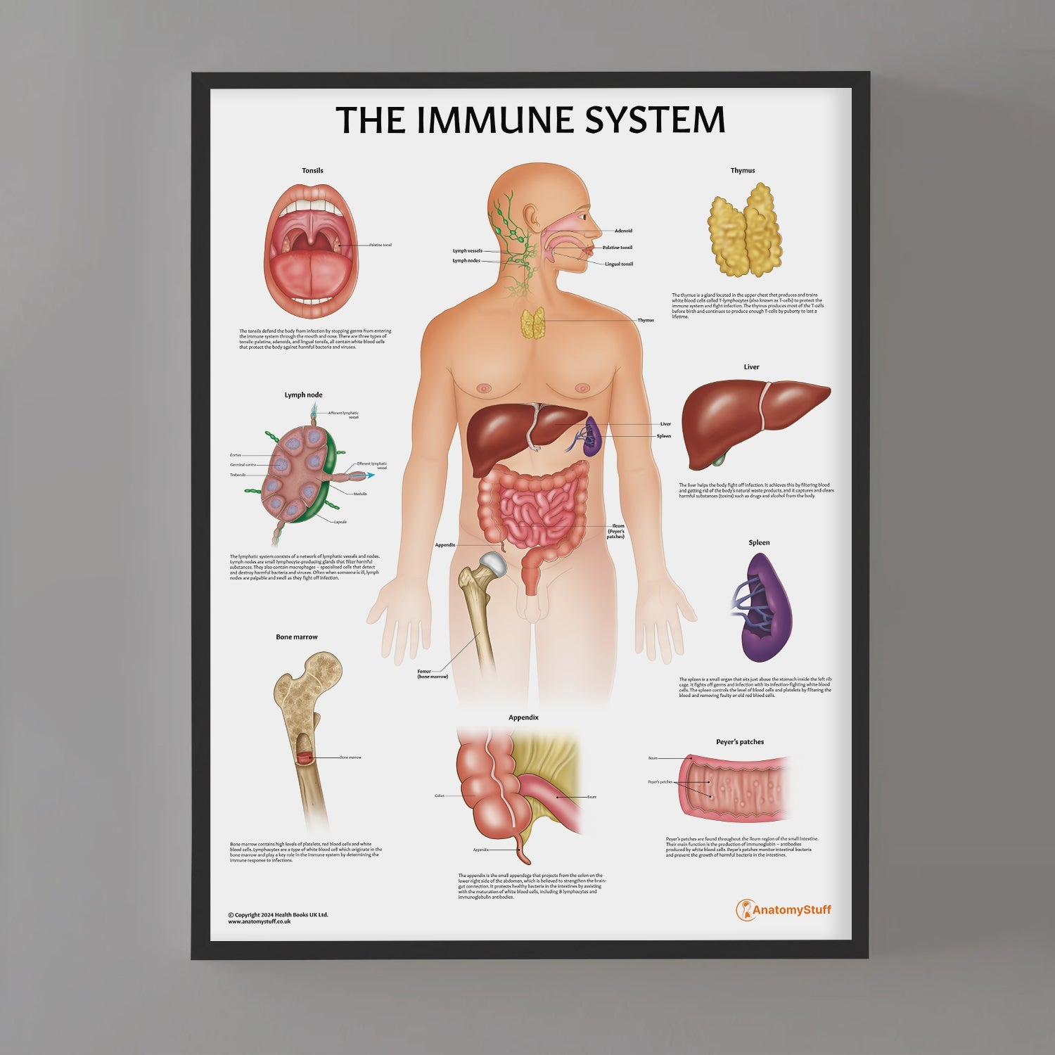 Immune System Anatomy Chart / Poster - Part of Collection