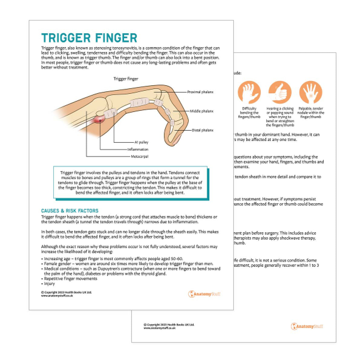 Trigger Finger Patient Education Handout (Printable PDF)
