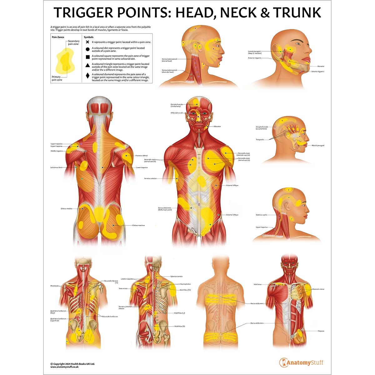 Trigger Points 3 Poster Collection