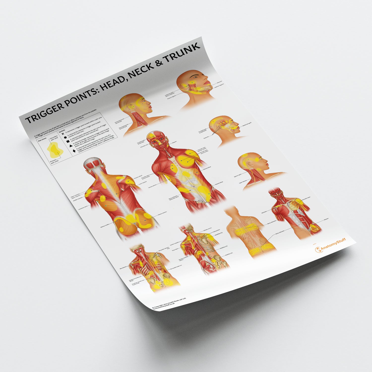 Trigger Points: Head, Neck & Trunk Chart / Poster - Part of Collection
