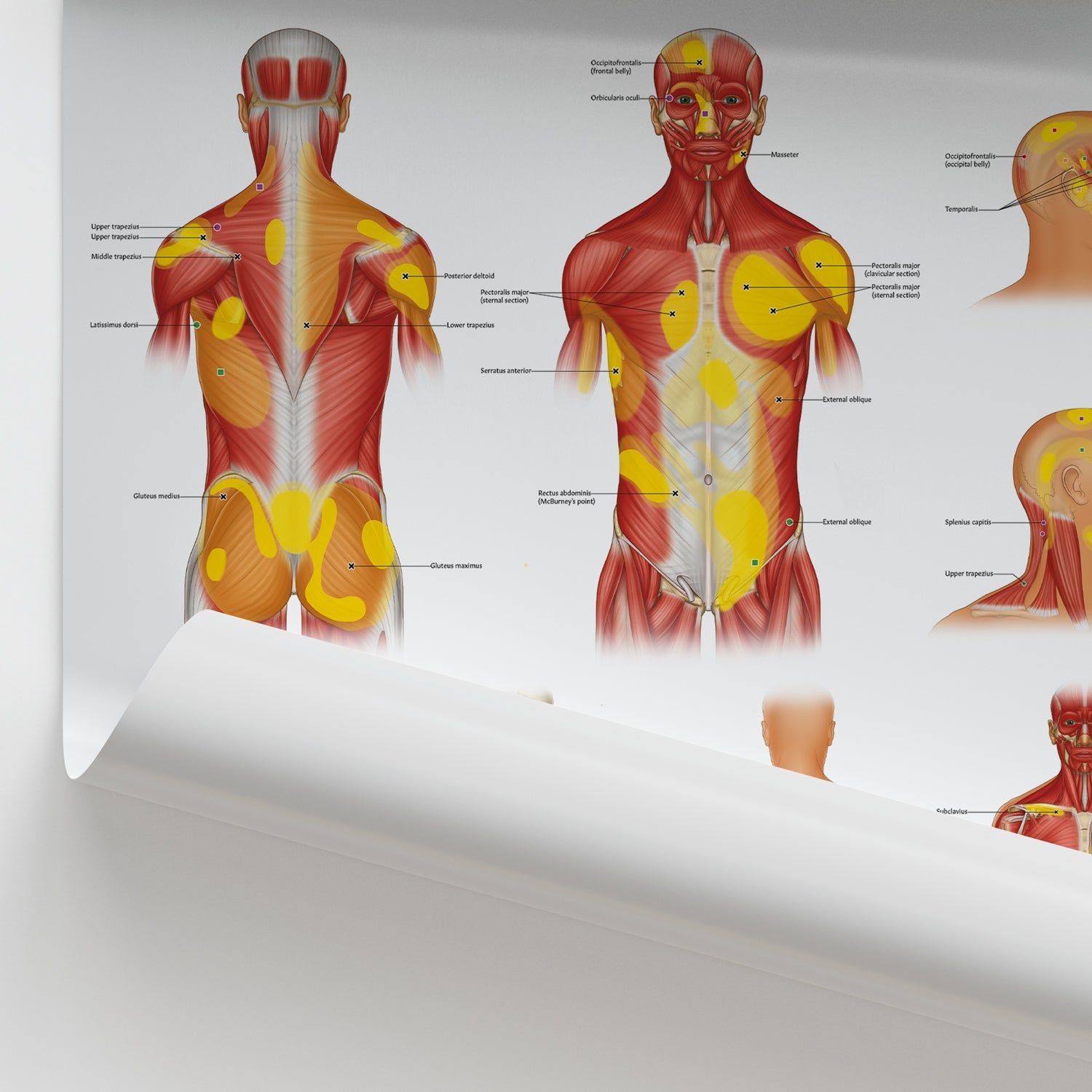 Trigger Points: Head, Neck & Trunk Chart / Poster - Part of Collection
