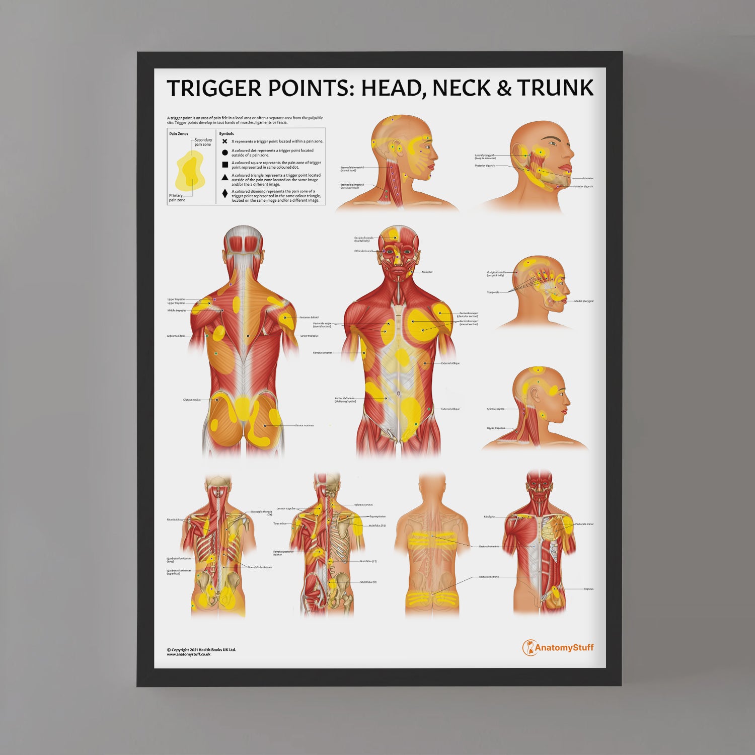 Trigger Points: Head, Neck & Trunk Chart / Poster - Part of Collection