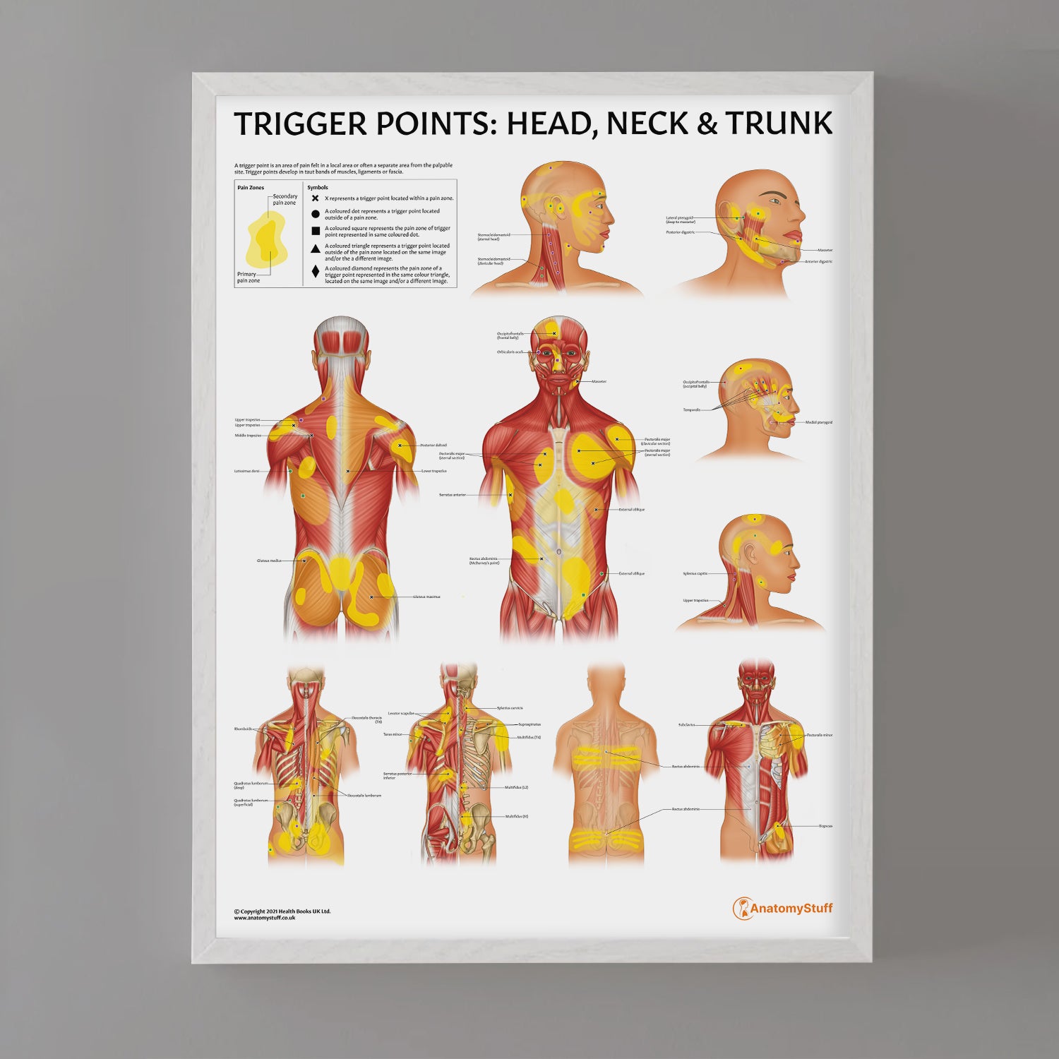 Trigger Points: Head, Neck & Trunk Chart / Poster - Part of Collection
