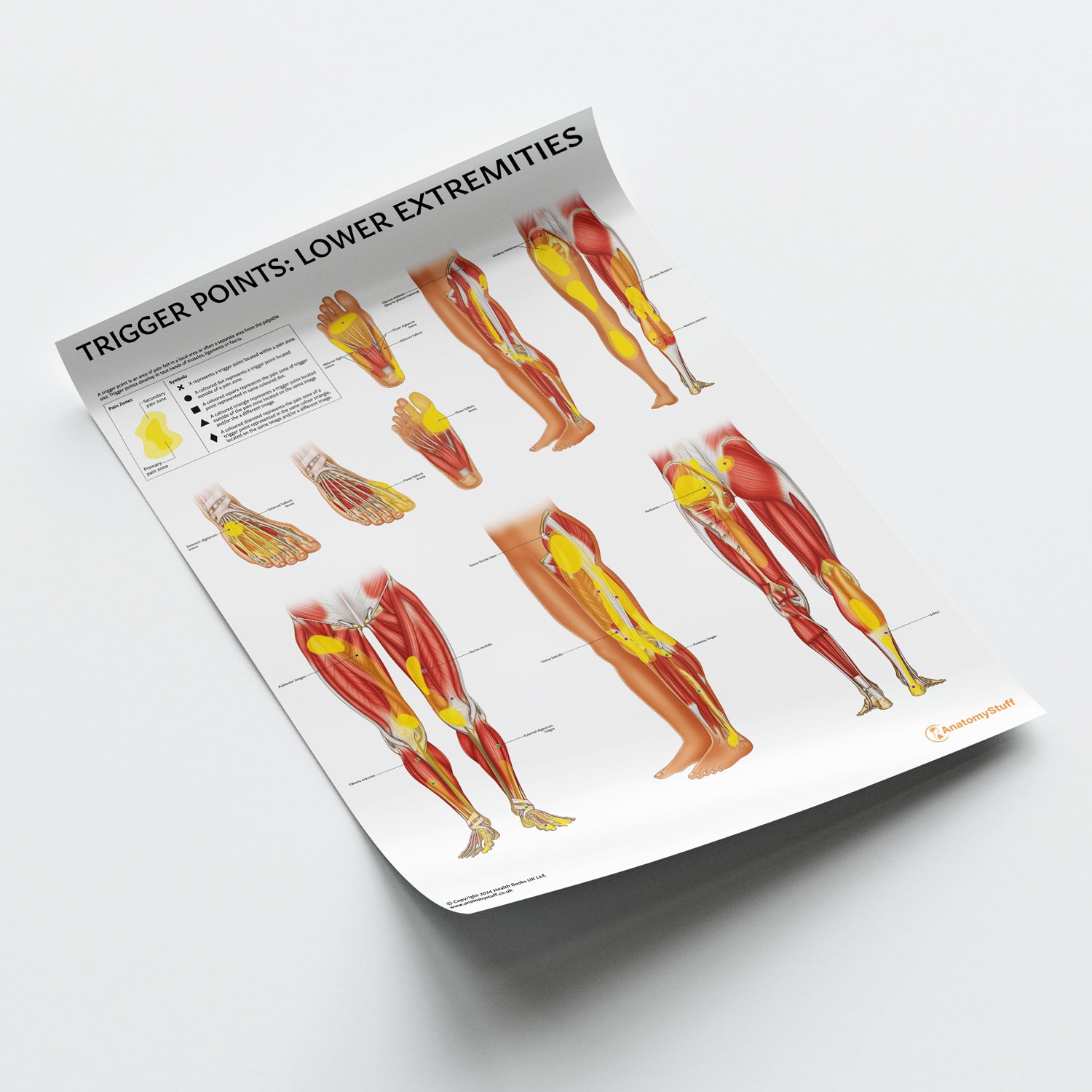 Trigger Points: Lower Extremities Chart / Poster - Part of Collection