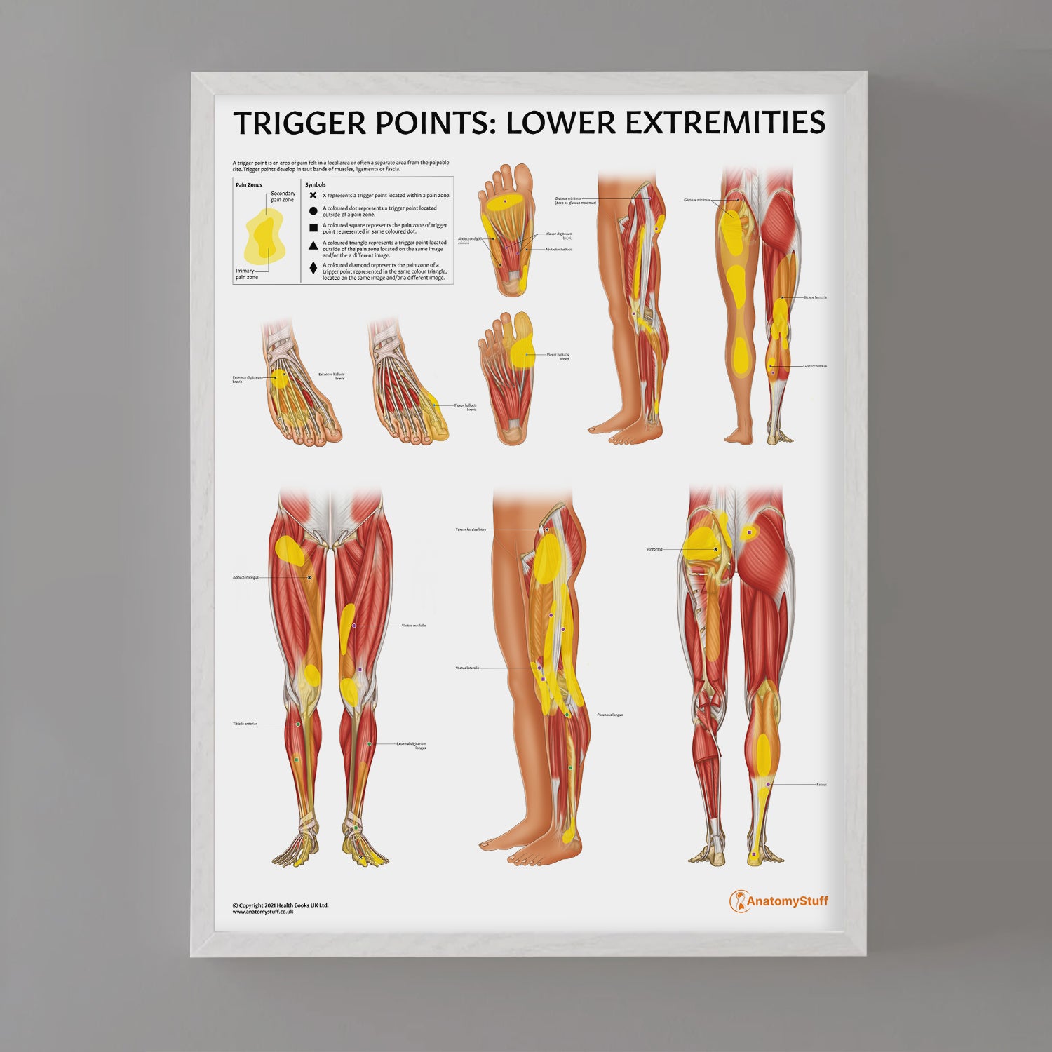 Trigger Points: Lower Extremities Chart / Poster - Part of Collection