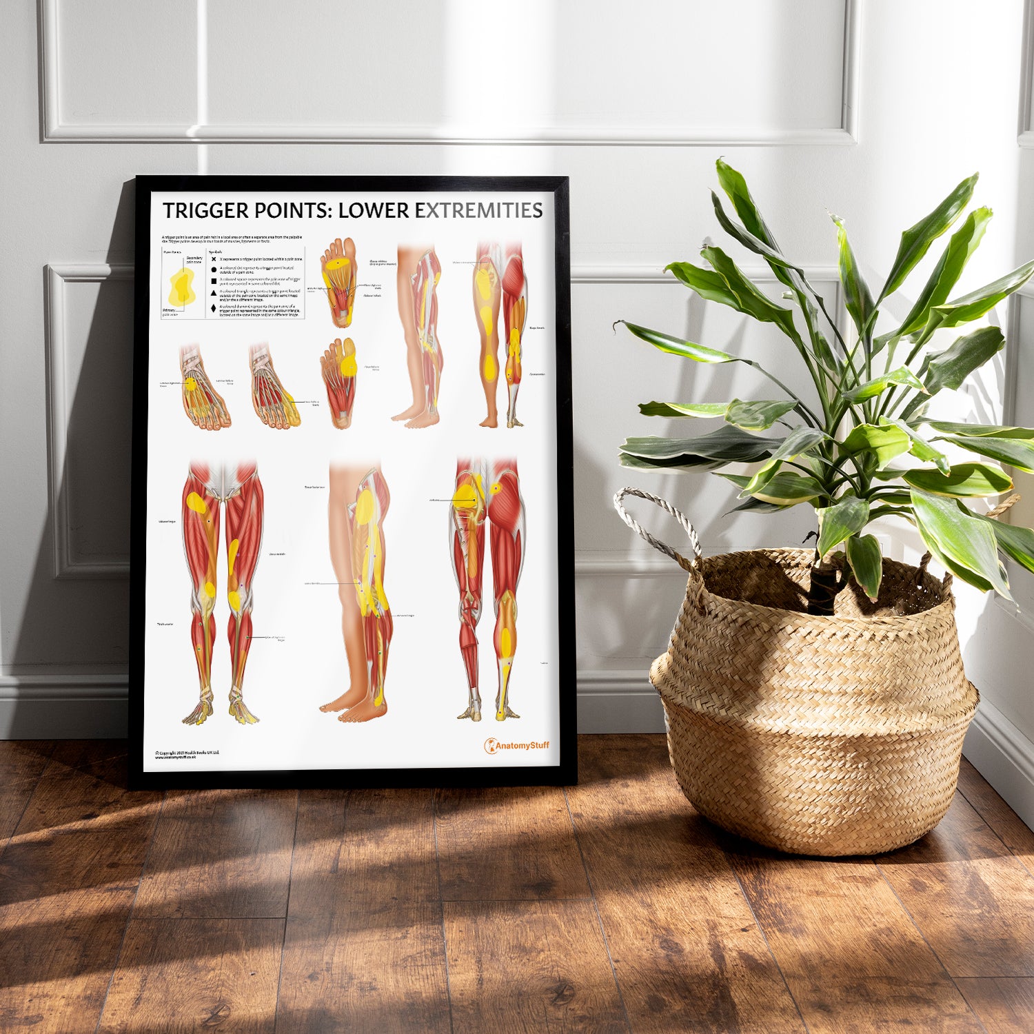 Trigger Points: Lower Extremities Chart / Poster - Part of Collection